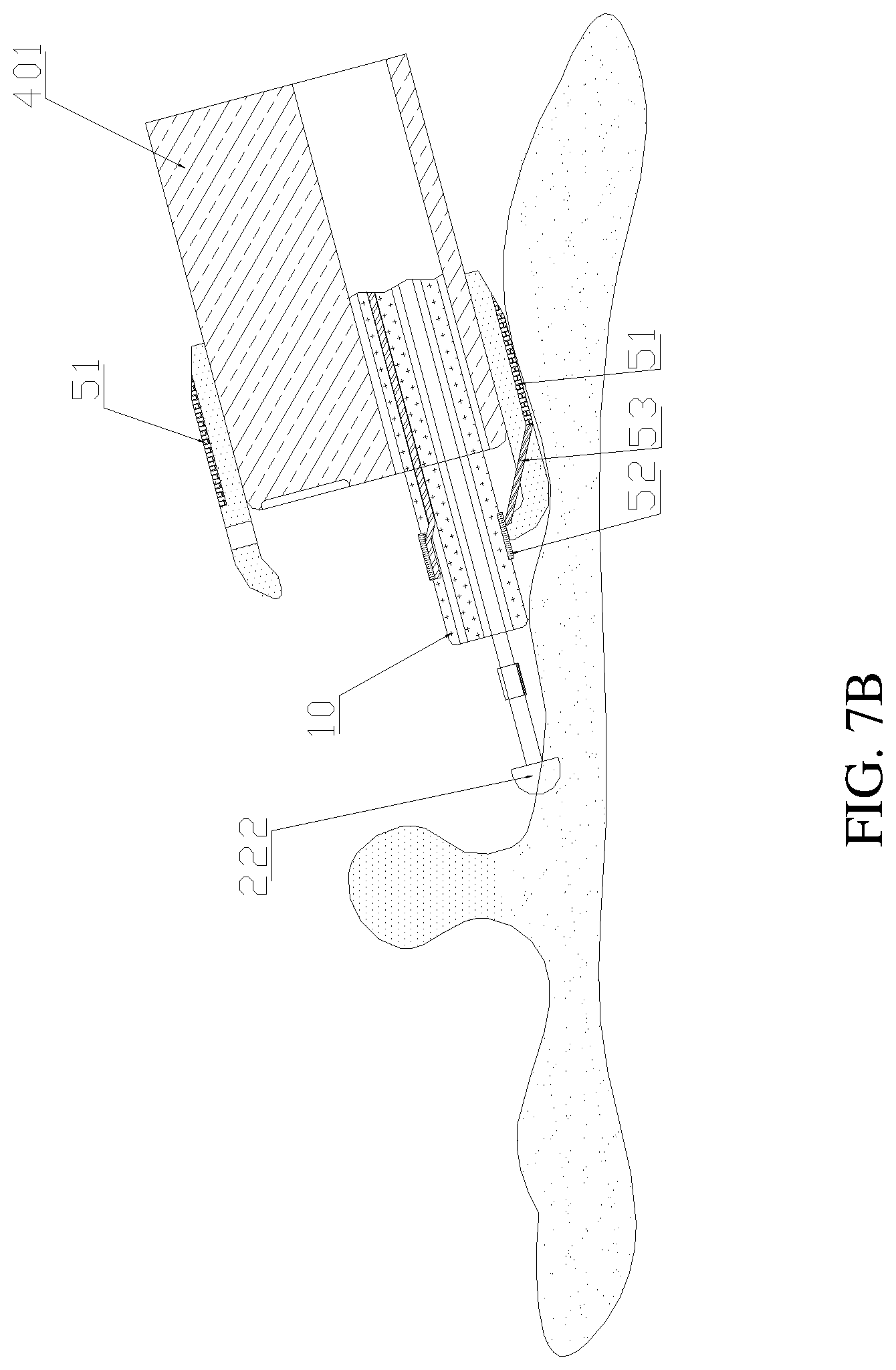 Patent US11771493 Figure 12 – Treatment apparatus for endoscope, endoscope, and expandable frame