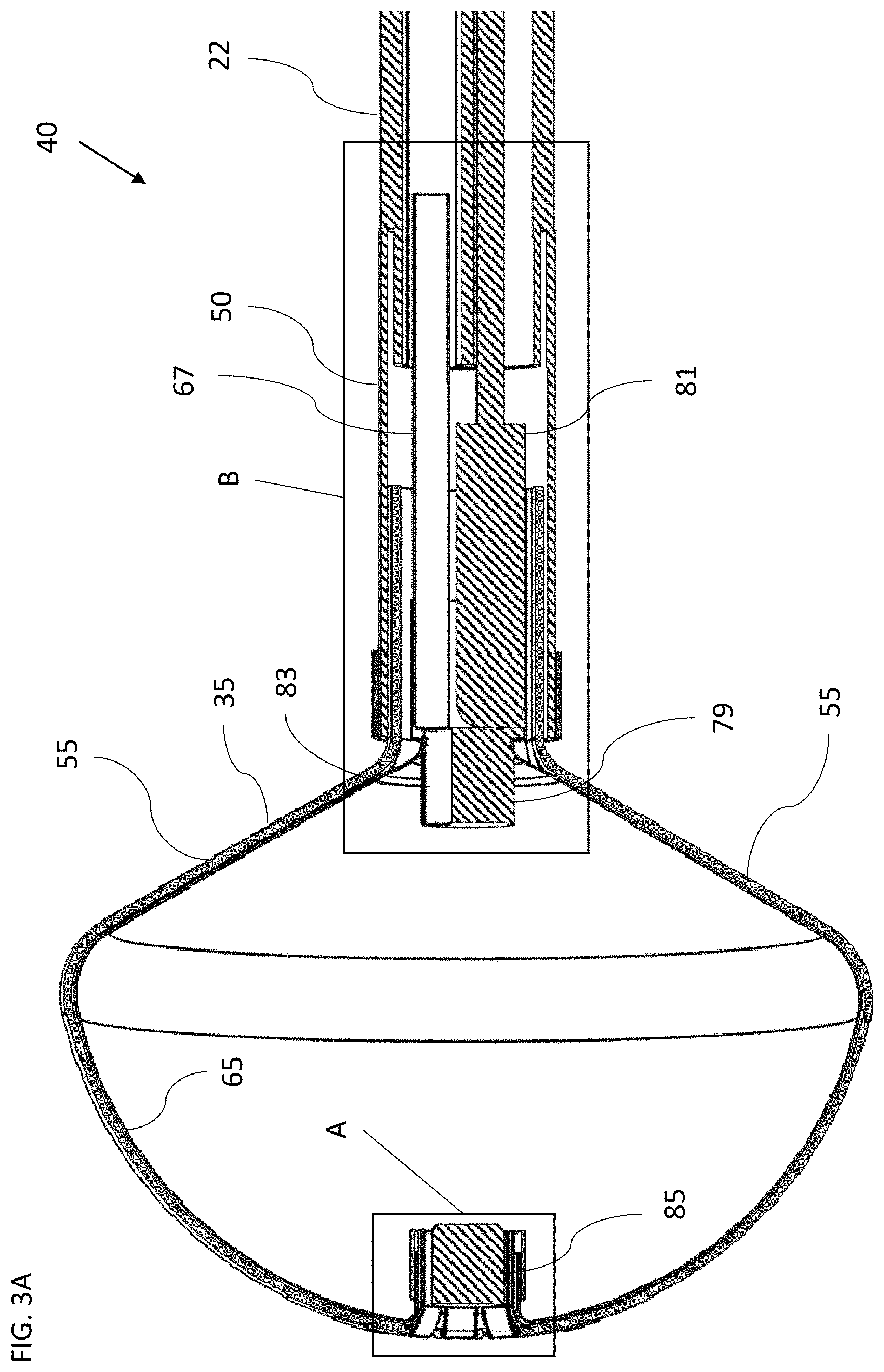 Patent US11771495 Figure 3 – Basket catheter with balloon