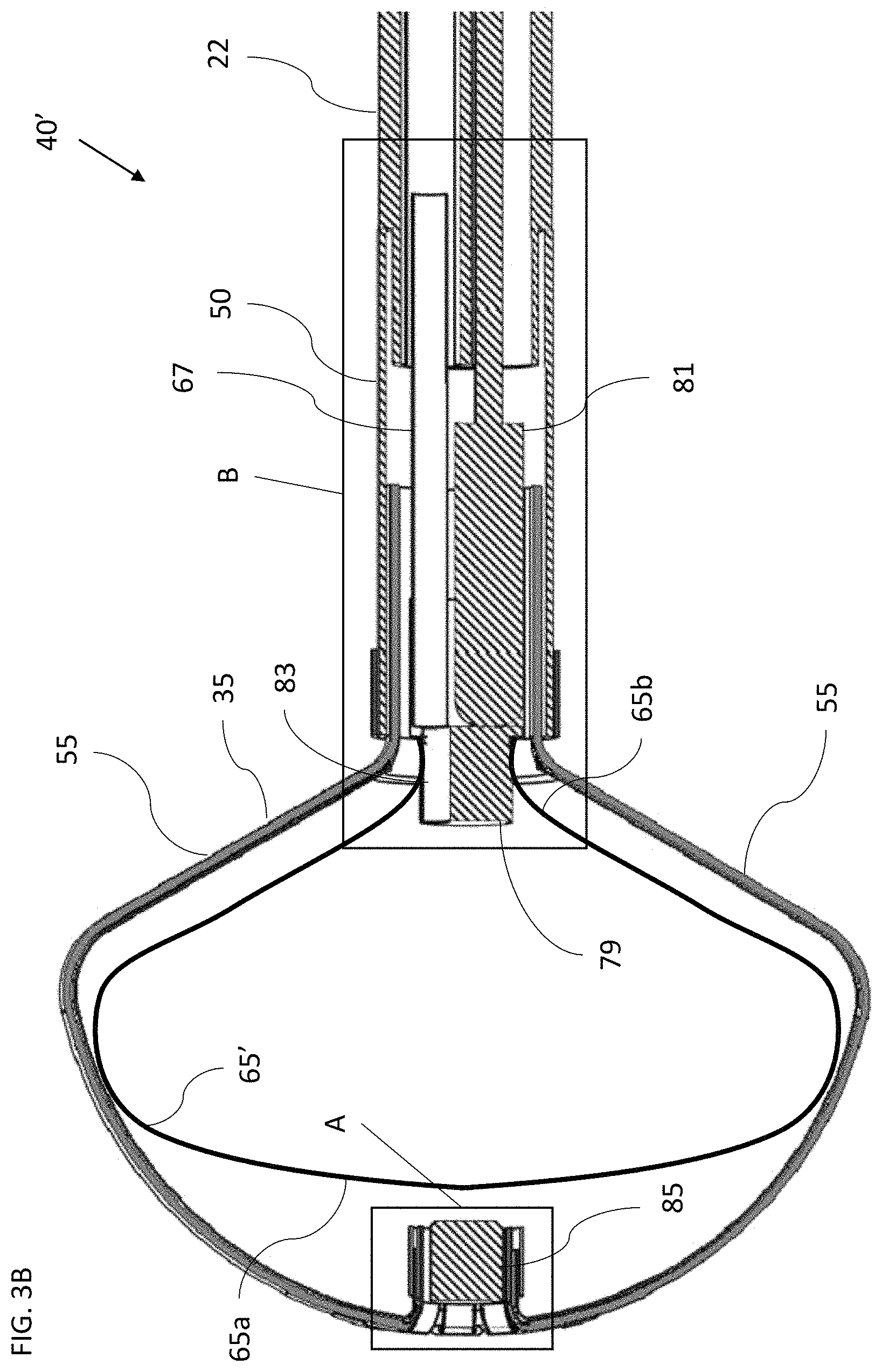 Patent US11771495 Figure 4 – Basket catheter with balloon