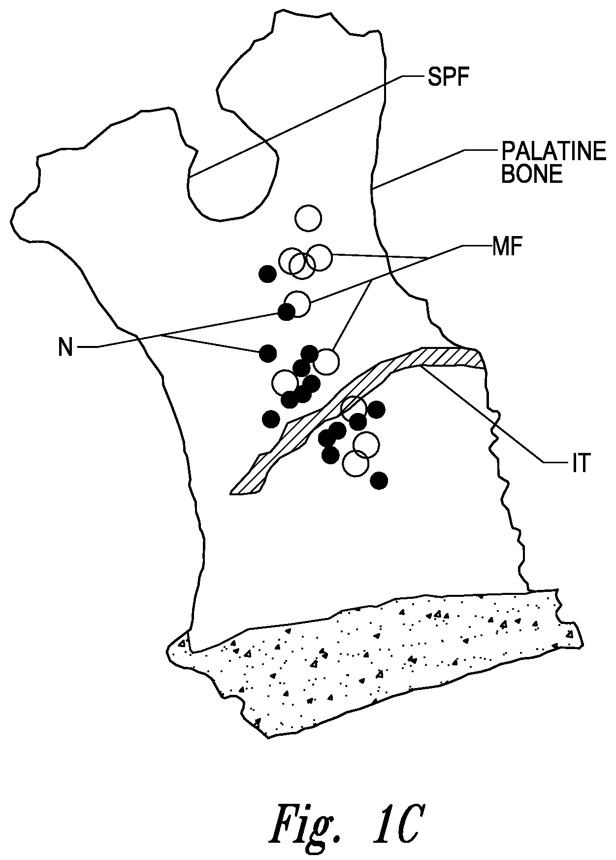 Patent US11771497 Figure 2 – Devices for therapeutic nasal neuromodulation and associated methods and systems