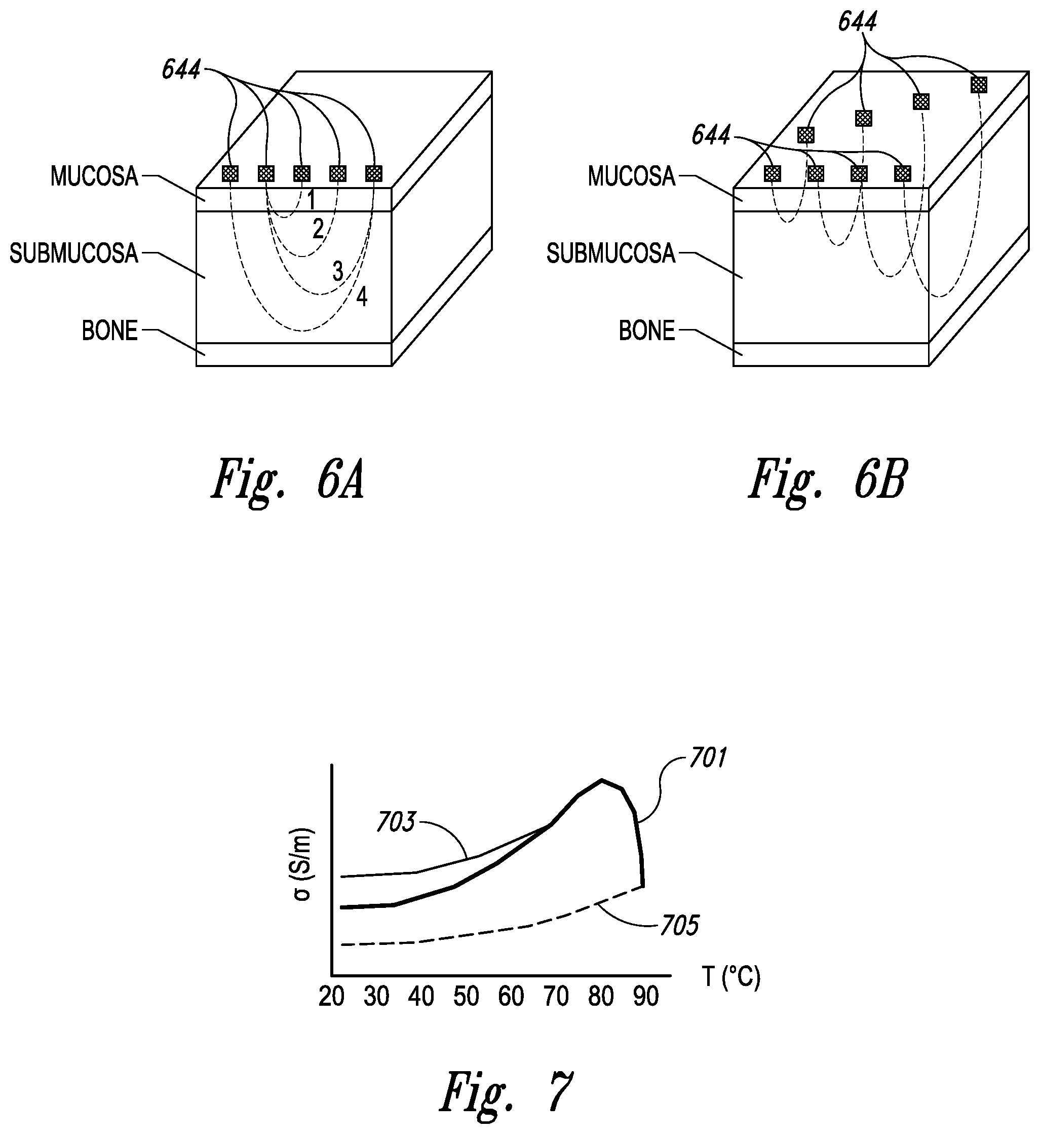 Patent US11771497 Figure 17 – Devices for therapeutic nasal neuromodulation and associated methods and systems