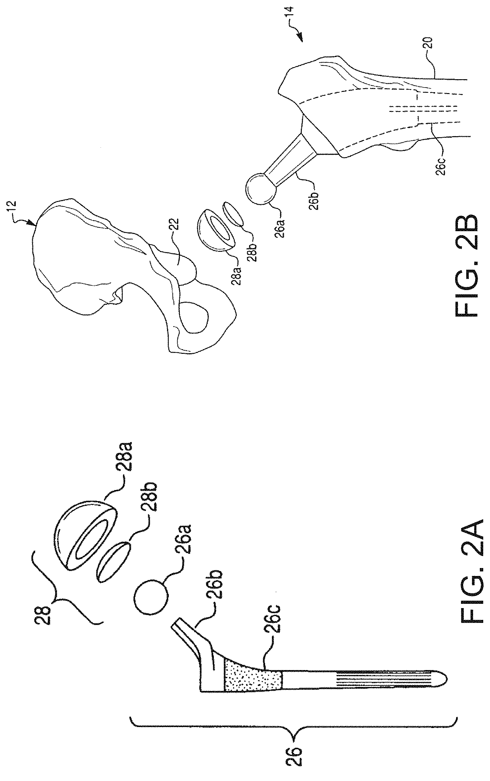 Patent US11771498 Figure 2 – Lower extremities leg length calculation method