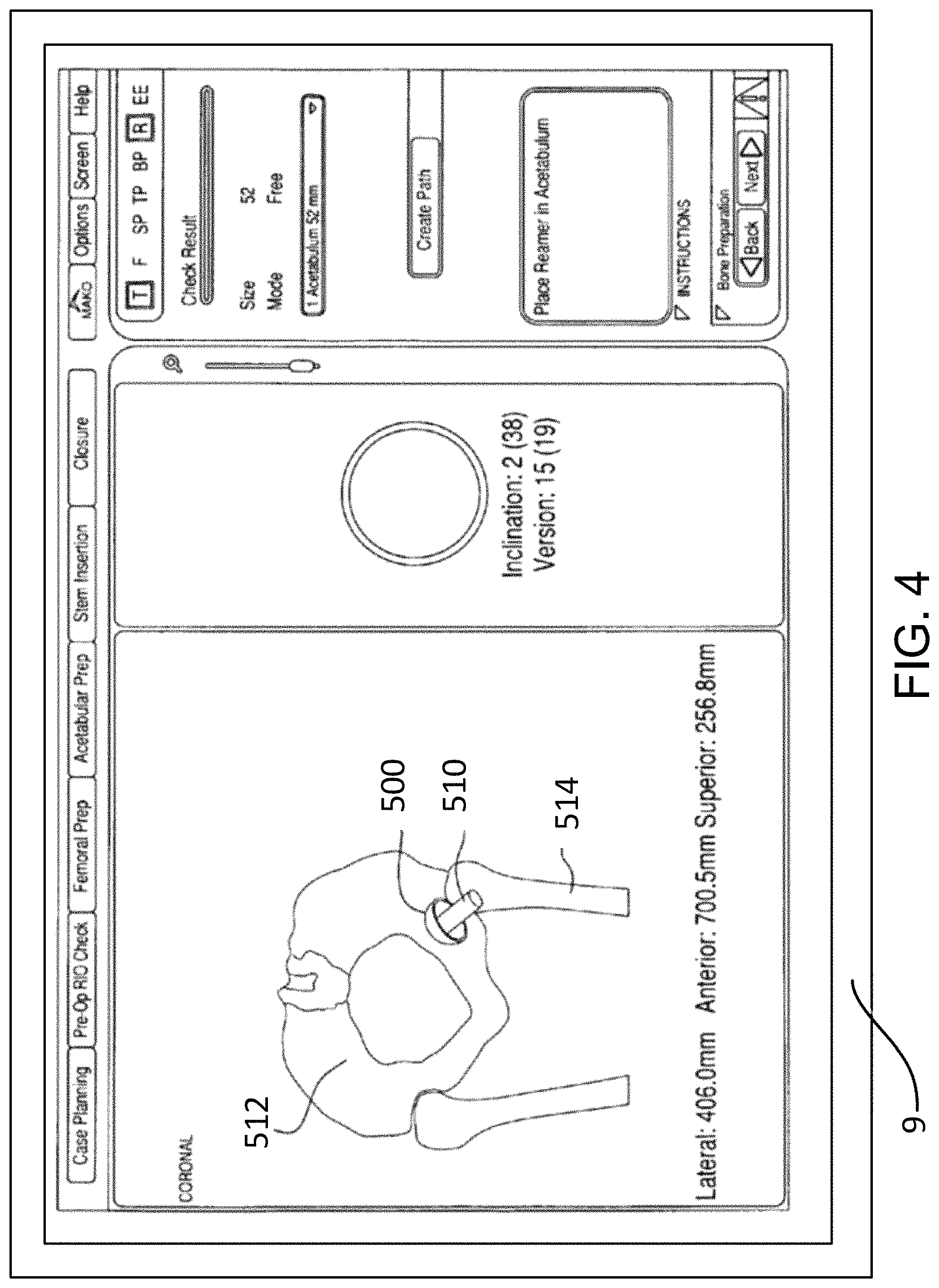 Patent US11771498 Figure 5 – Lower extremities leg length calculation method