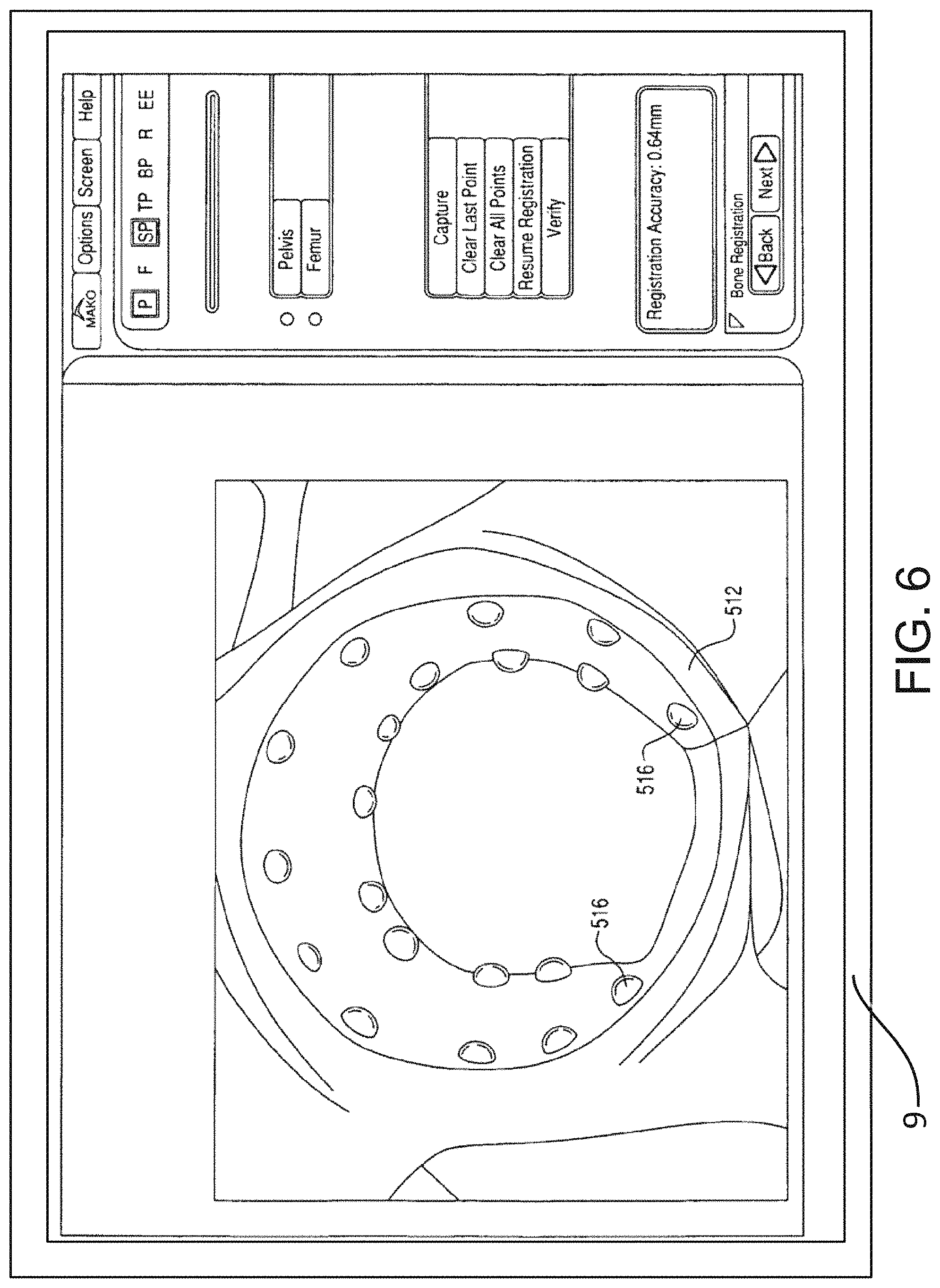 Patent US11771498 Figure 8 – Lower extremities leg length calculation method
