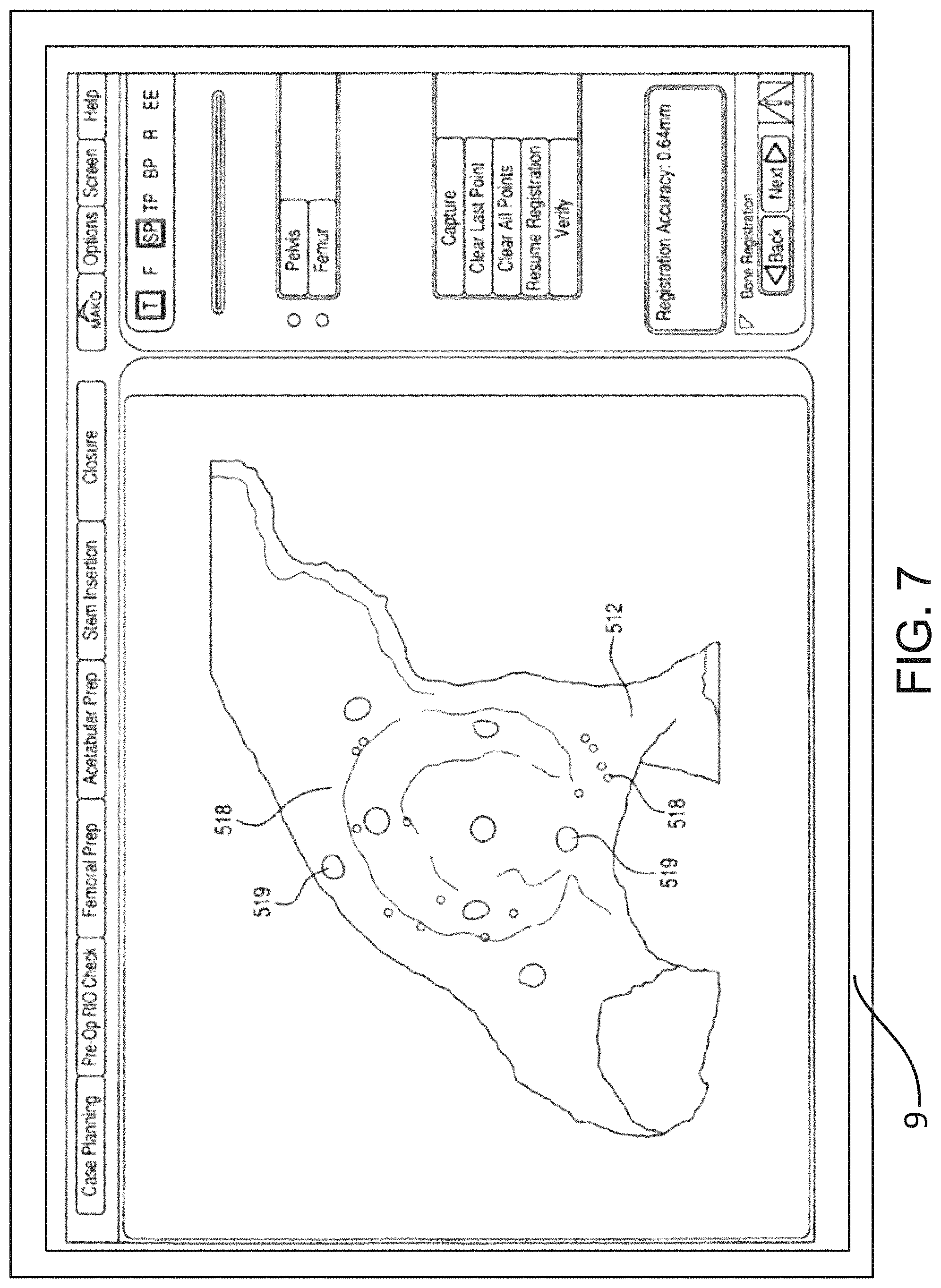 Patent US11771498 Figure 9 – Lower extremities leg length calculation method