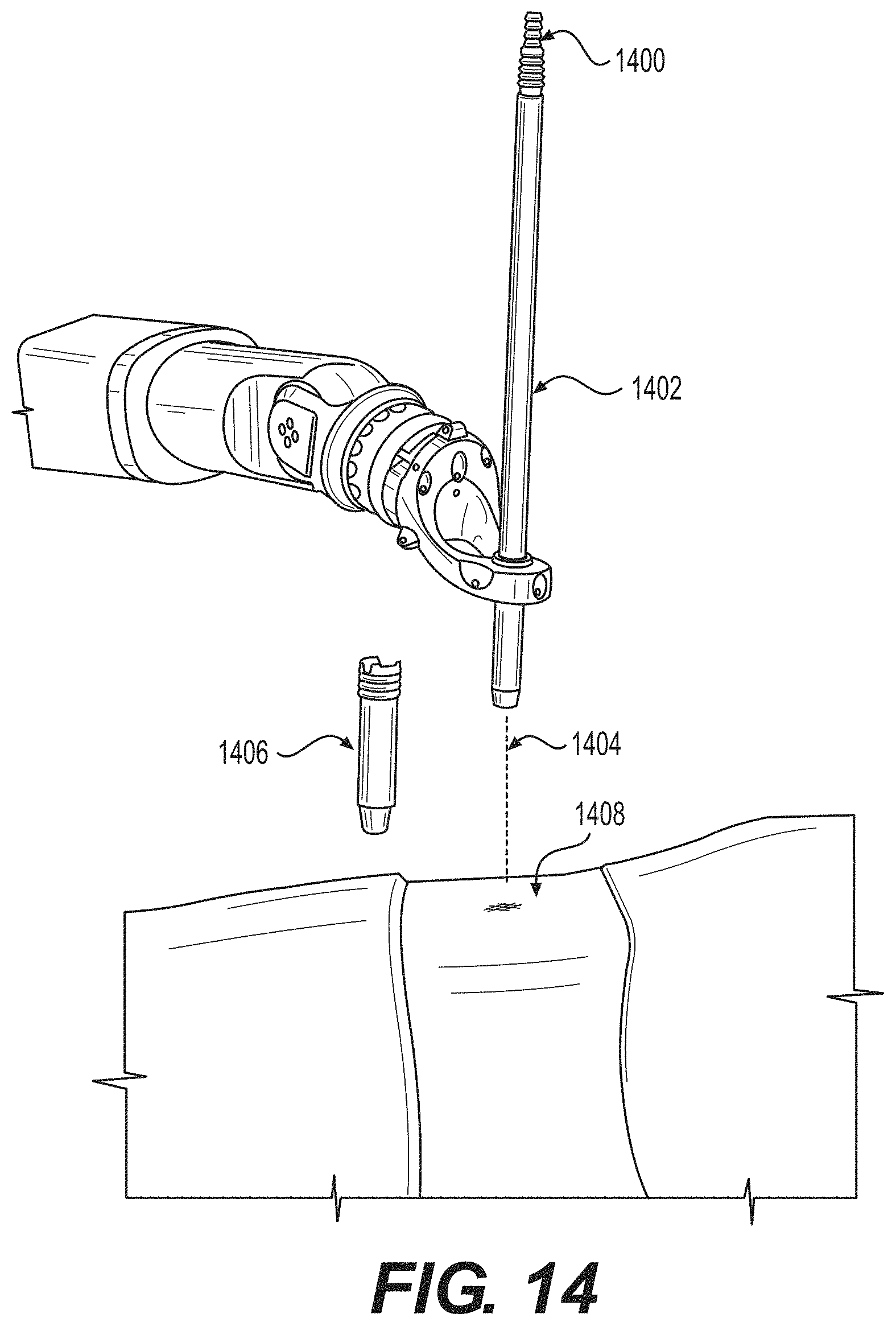 Patent US11771499 Figure 9 – Robot surgical platform