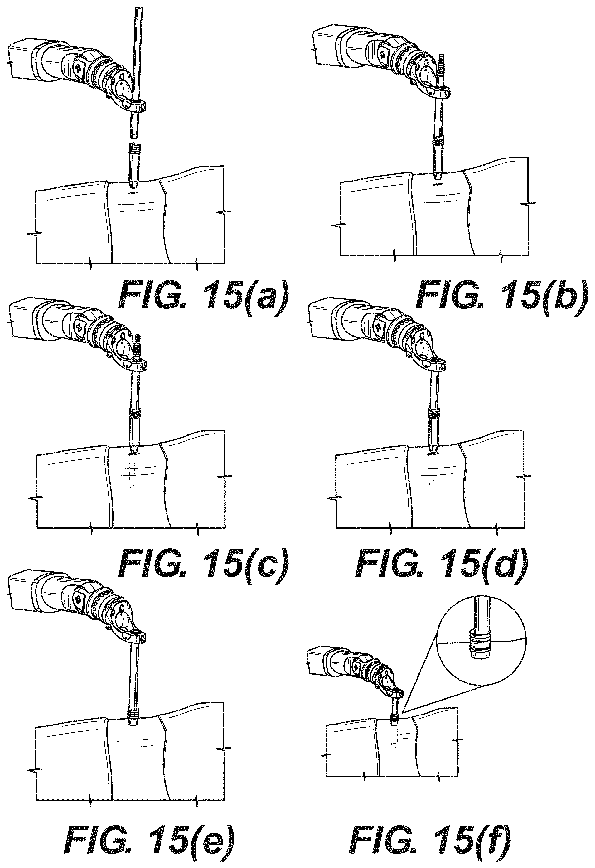 Patent US11771499 Figure 10 – Robot surgical platform
