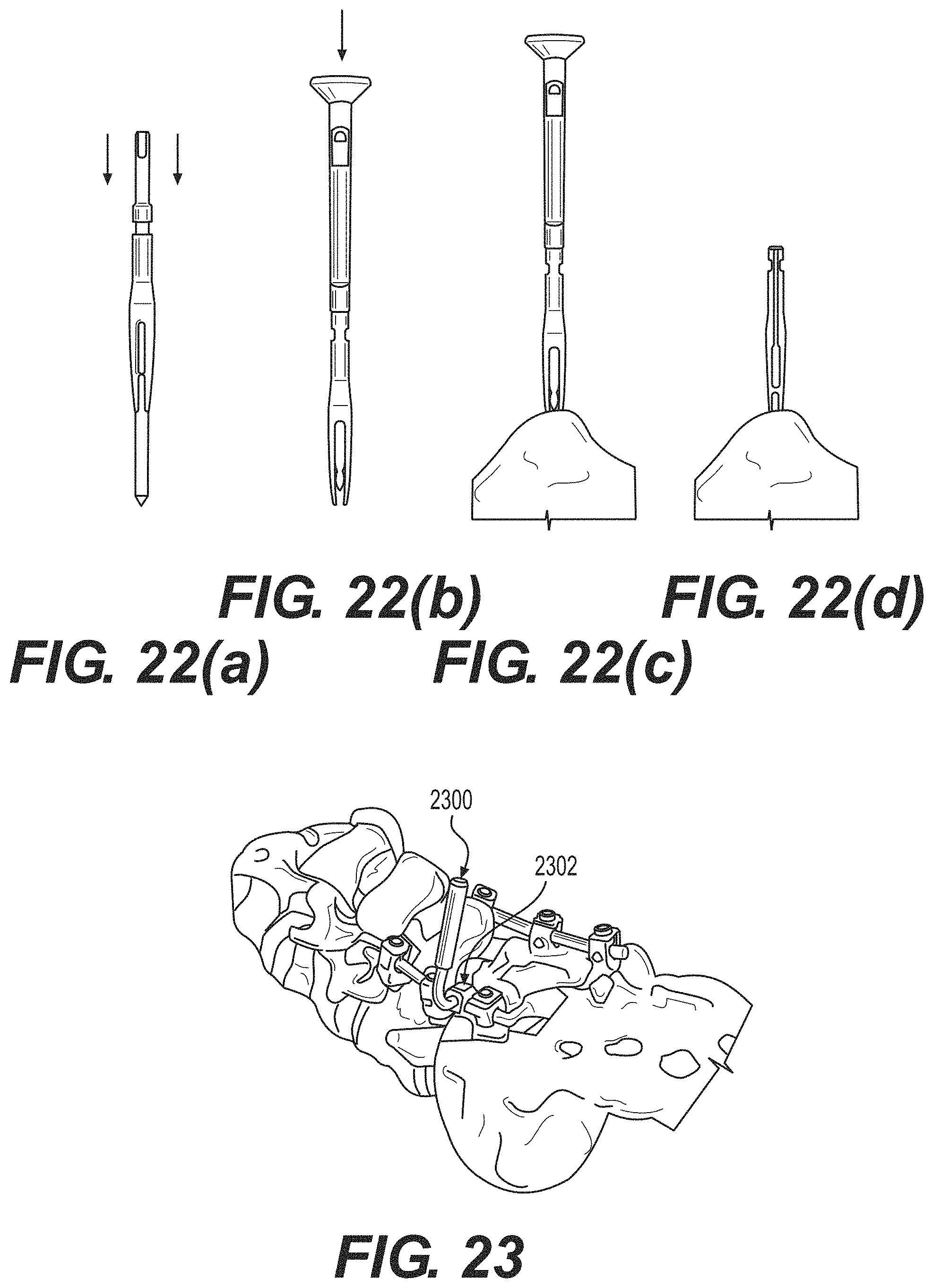 Patent US11771499 Figure 14 – Robot surgical platform