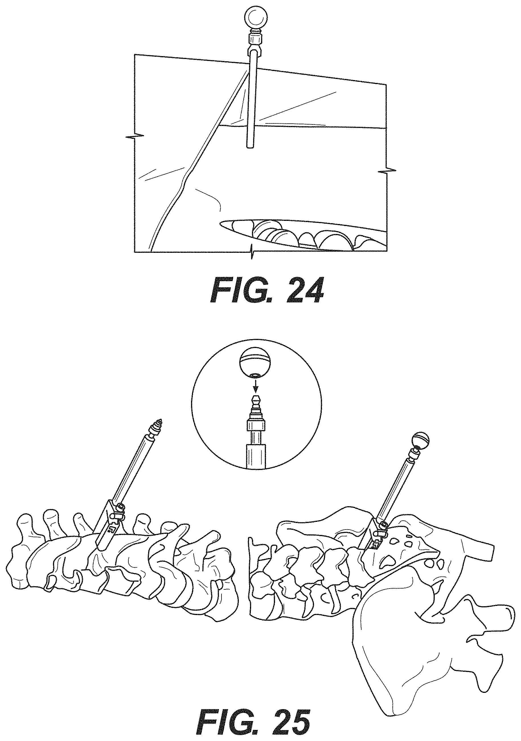 Patent US11771499 Figure 15 – Robot surgical platform