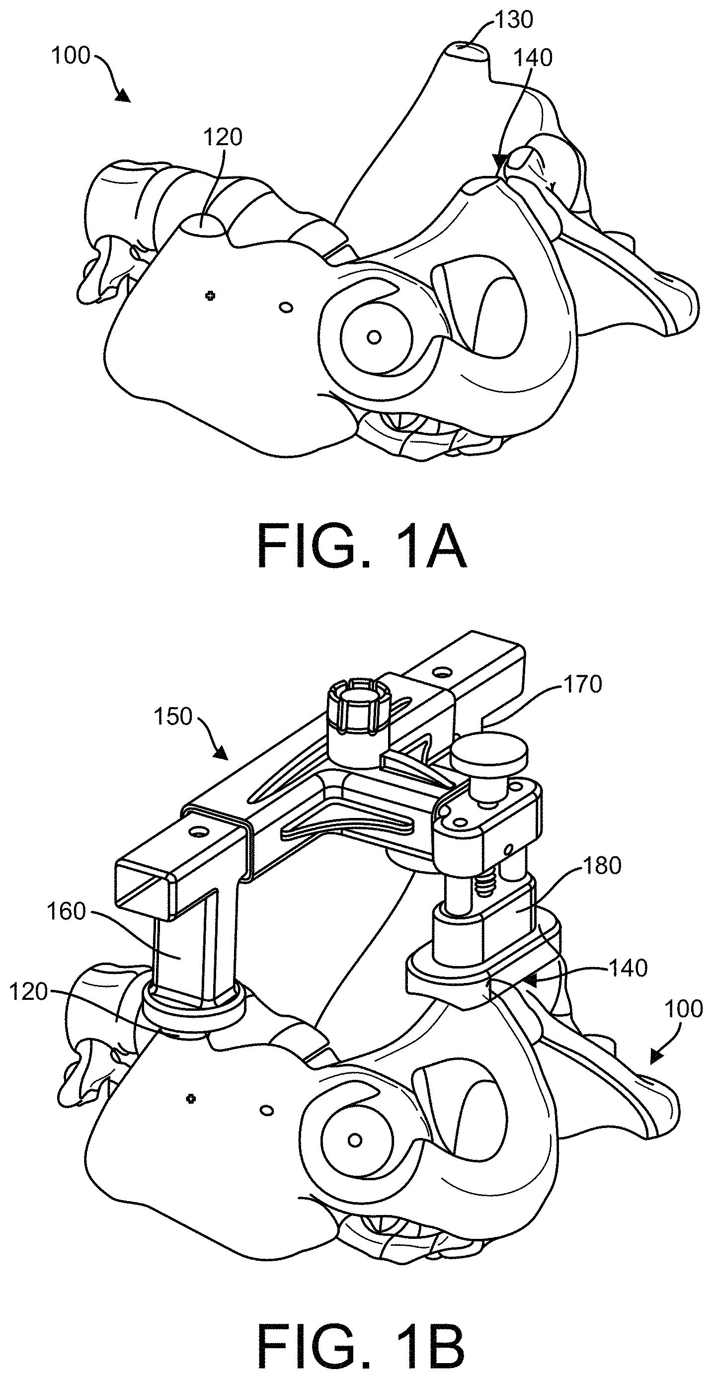 Patent US11771500 Figure 1 – Surgical navigation using a guide for instrumentation positioning