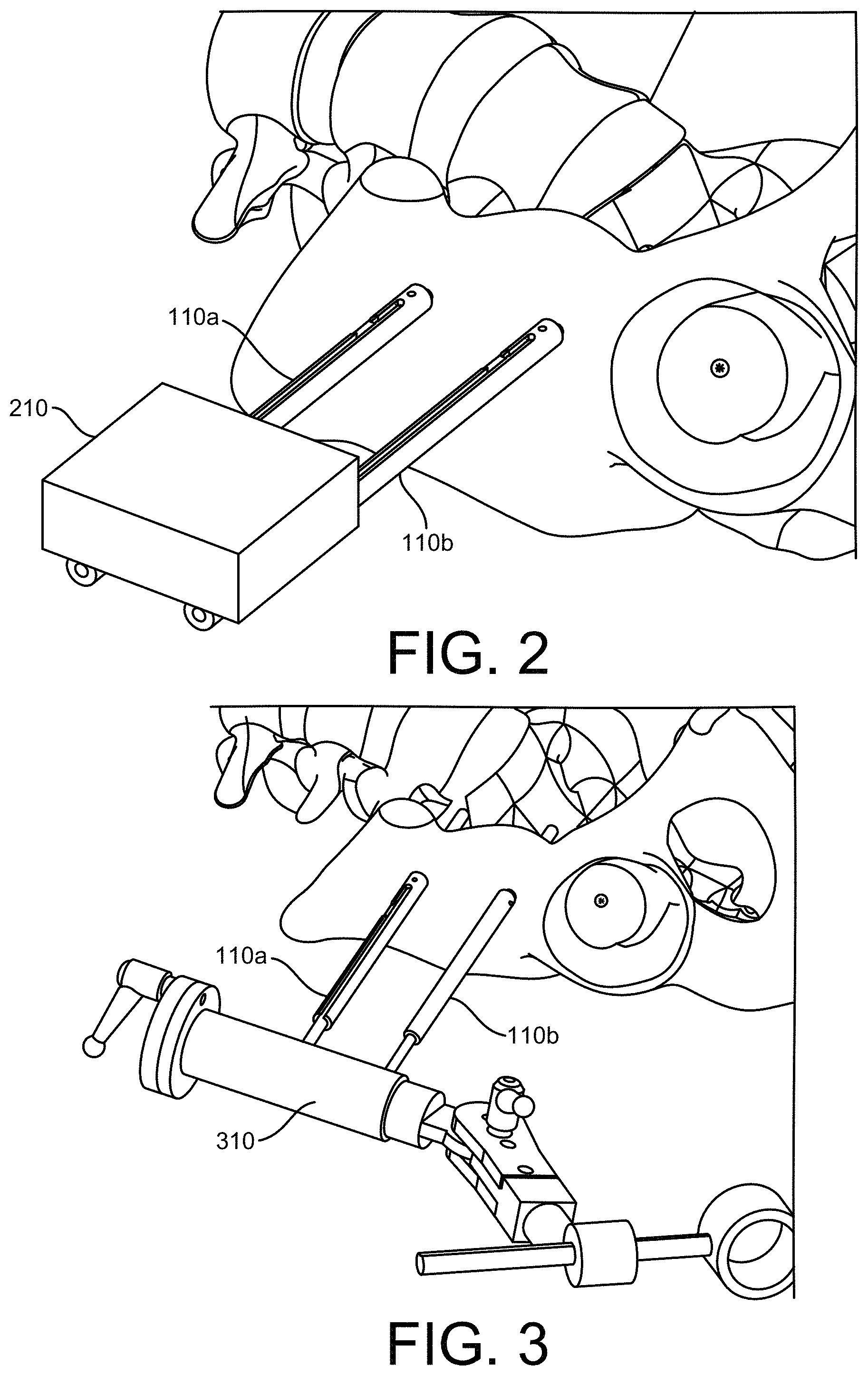 Patent US11771500 Figure 3 – Surgical navigation using a guide for instrumentation positioning