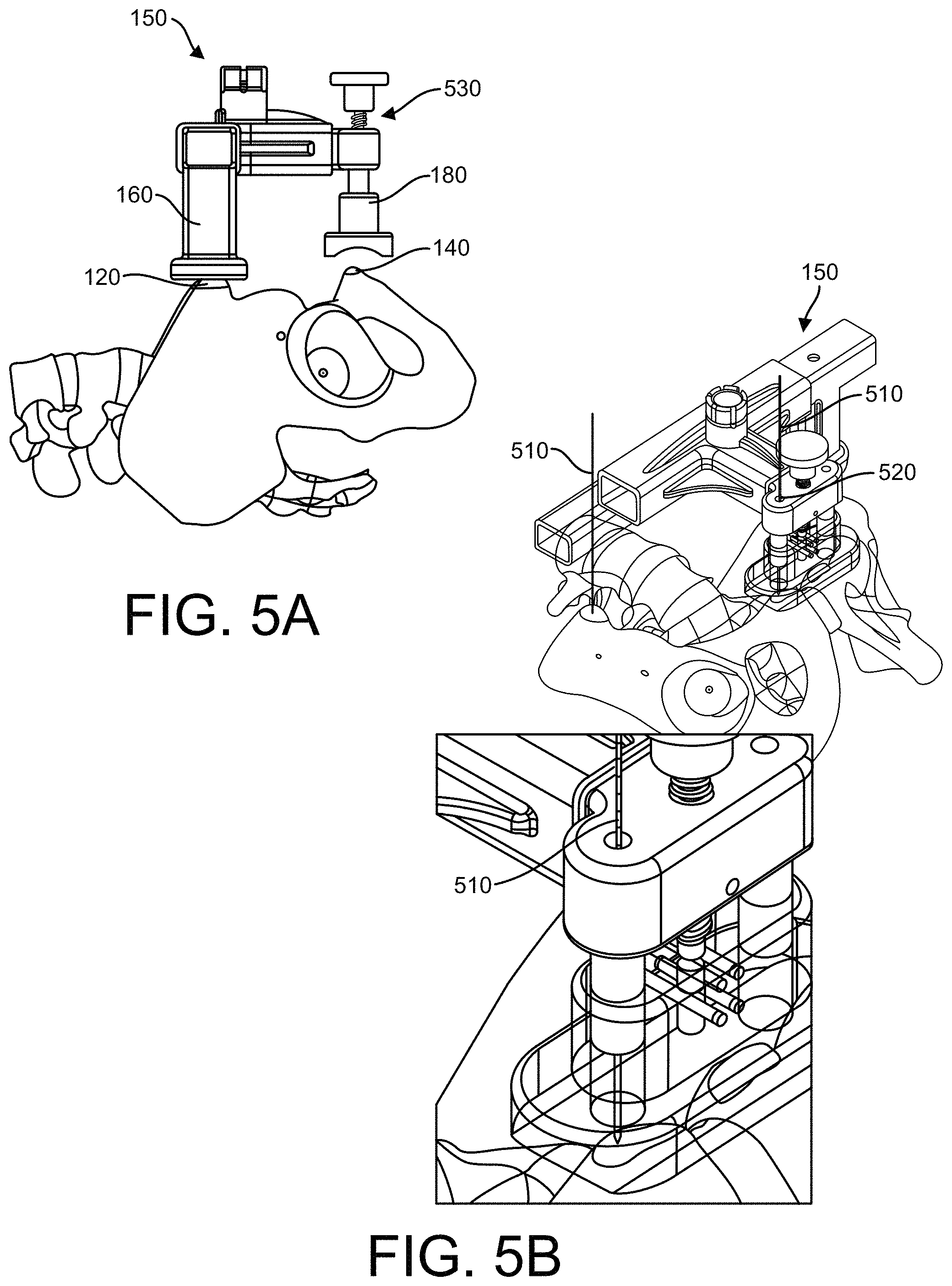 Patent US11771500 Figure 5 – Surgical navigation using a guide for instrumentation positioning