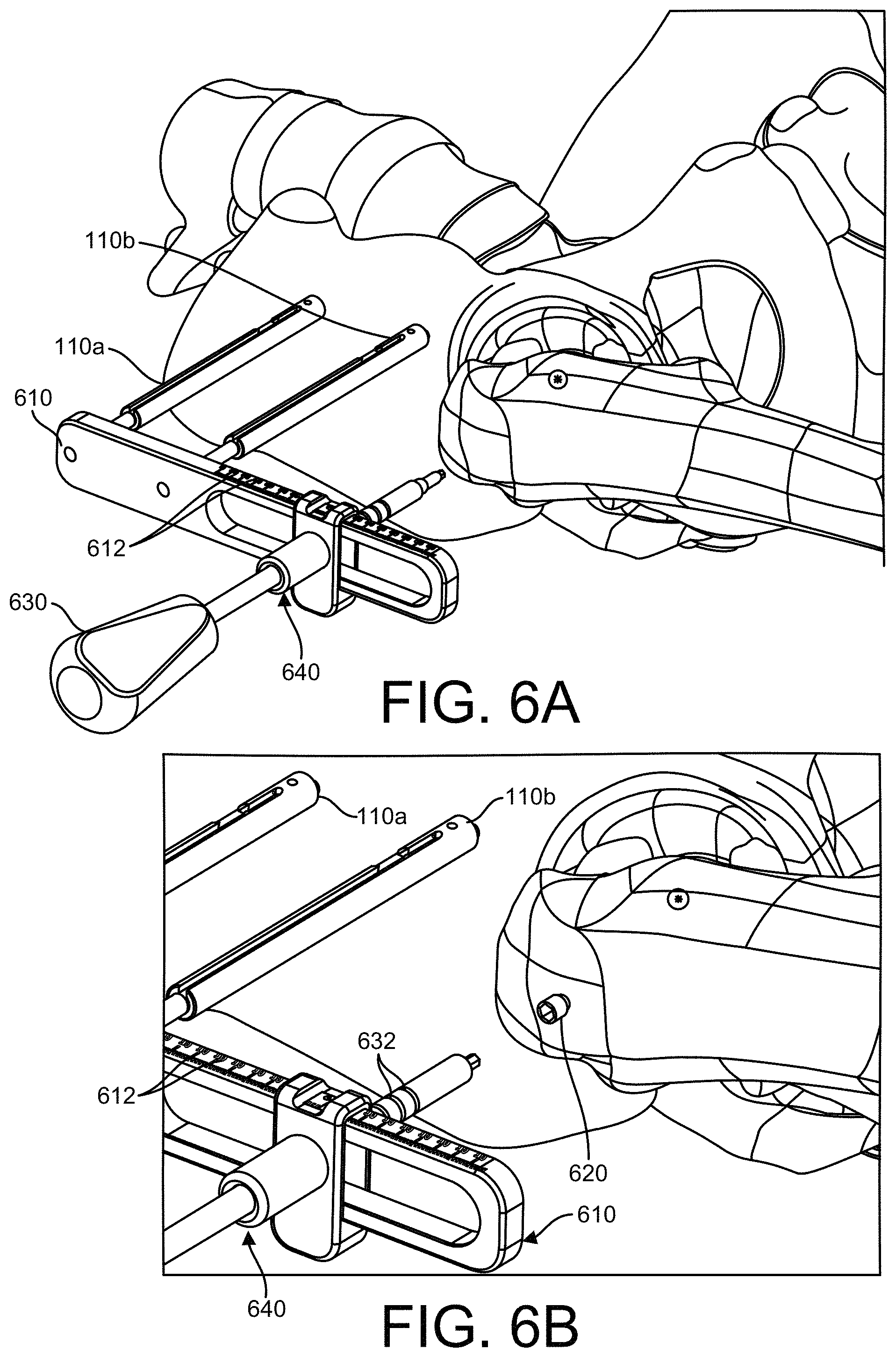 Patent US11771500 Figure 6 – Surgical navigation using a guide for instrumentation positioning