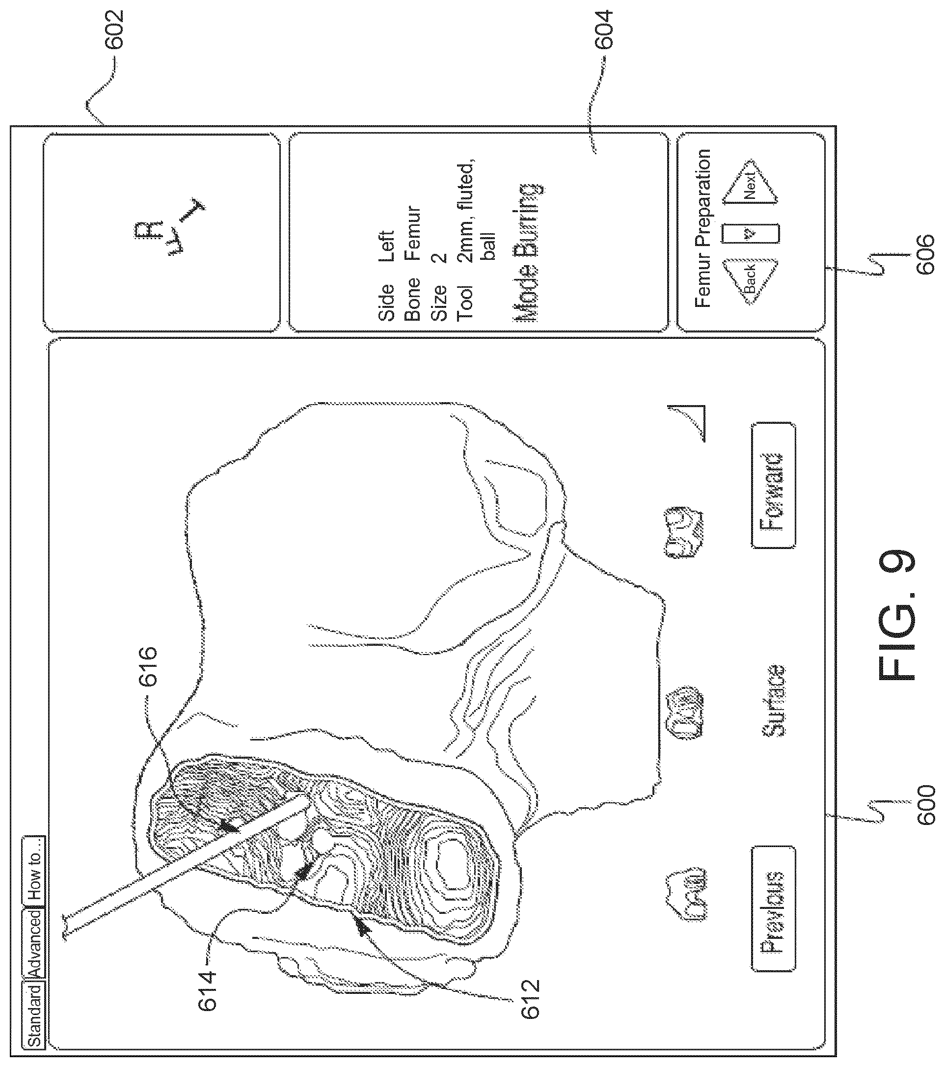 Patent US11771504 Figure 13 – Surgical system with base and arm tracking