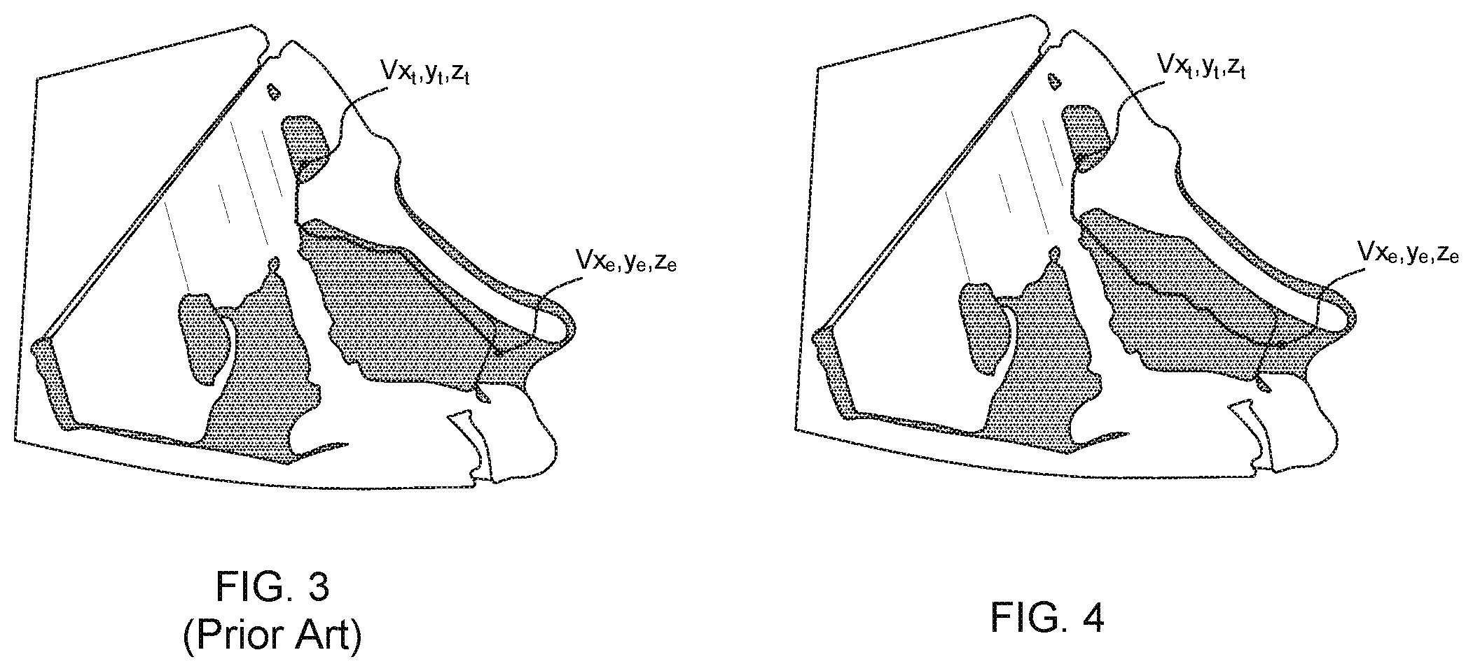 Patent US11771505 Figure 3 – Three dimensional mapping system for cranial surgical pathways and method