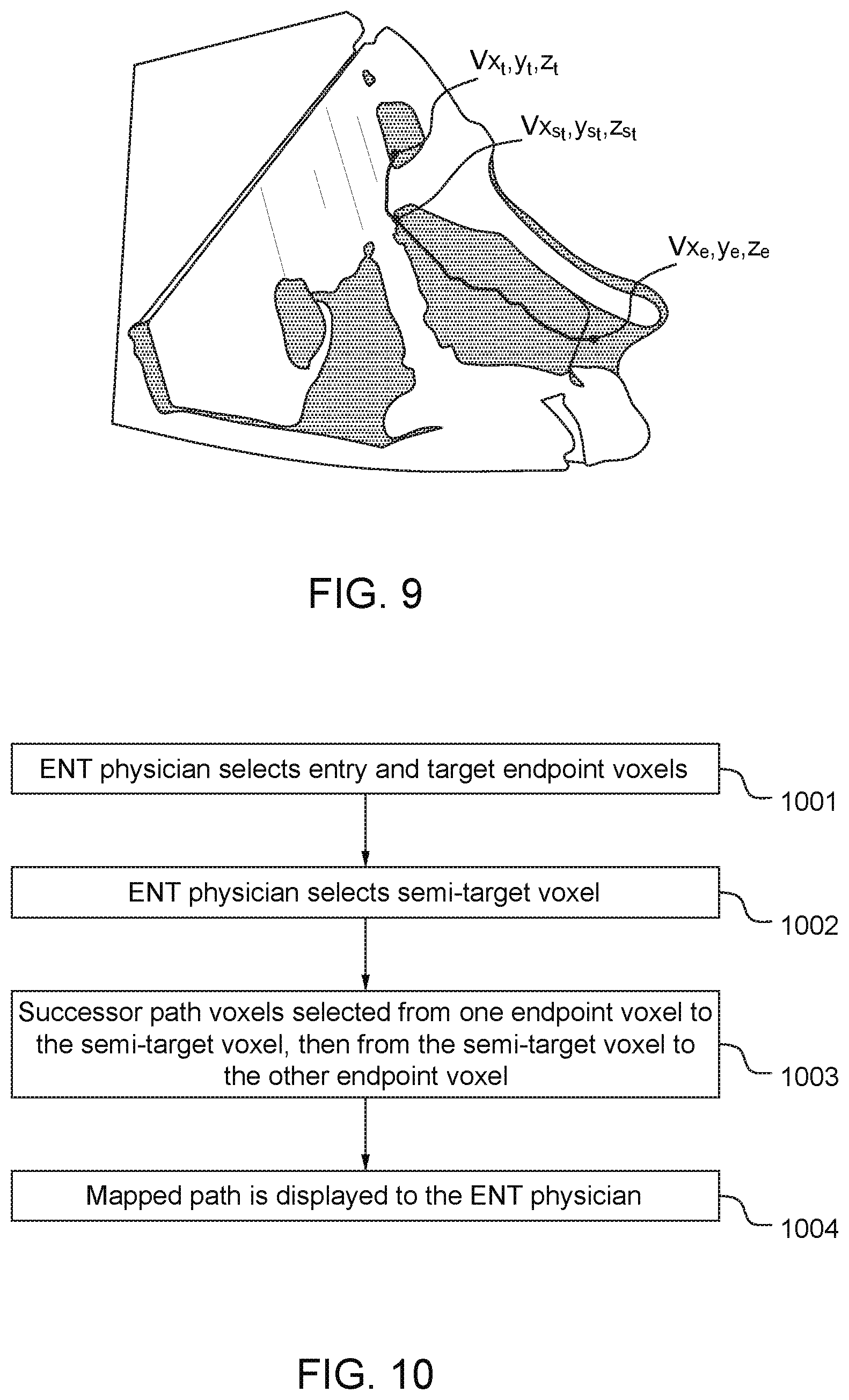 Patent US11771505 Figure 8 – Three dimensional mapping system for cranial surgical pathways and method