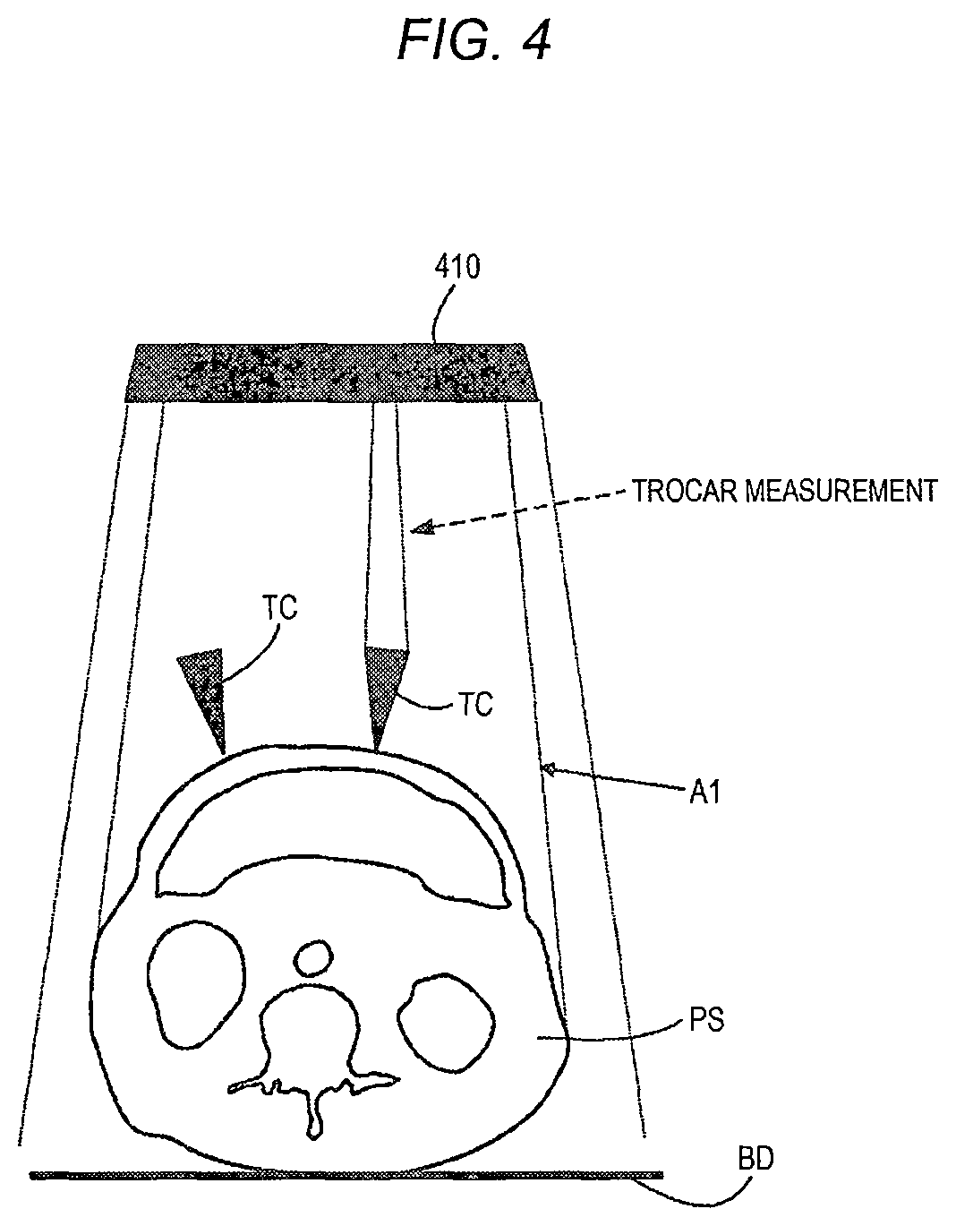 Patent US11771508 Figure 4 – Robotically-assisted surgical device, robotically-assisted surgery method, and system