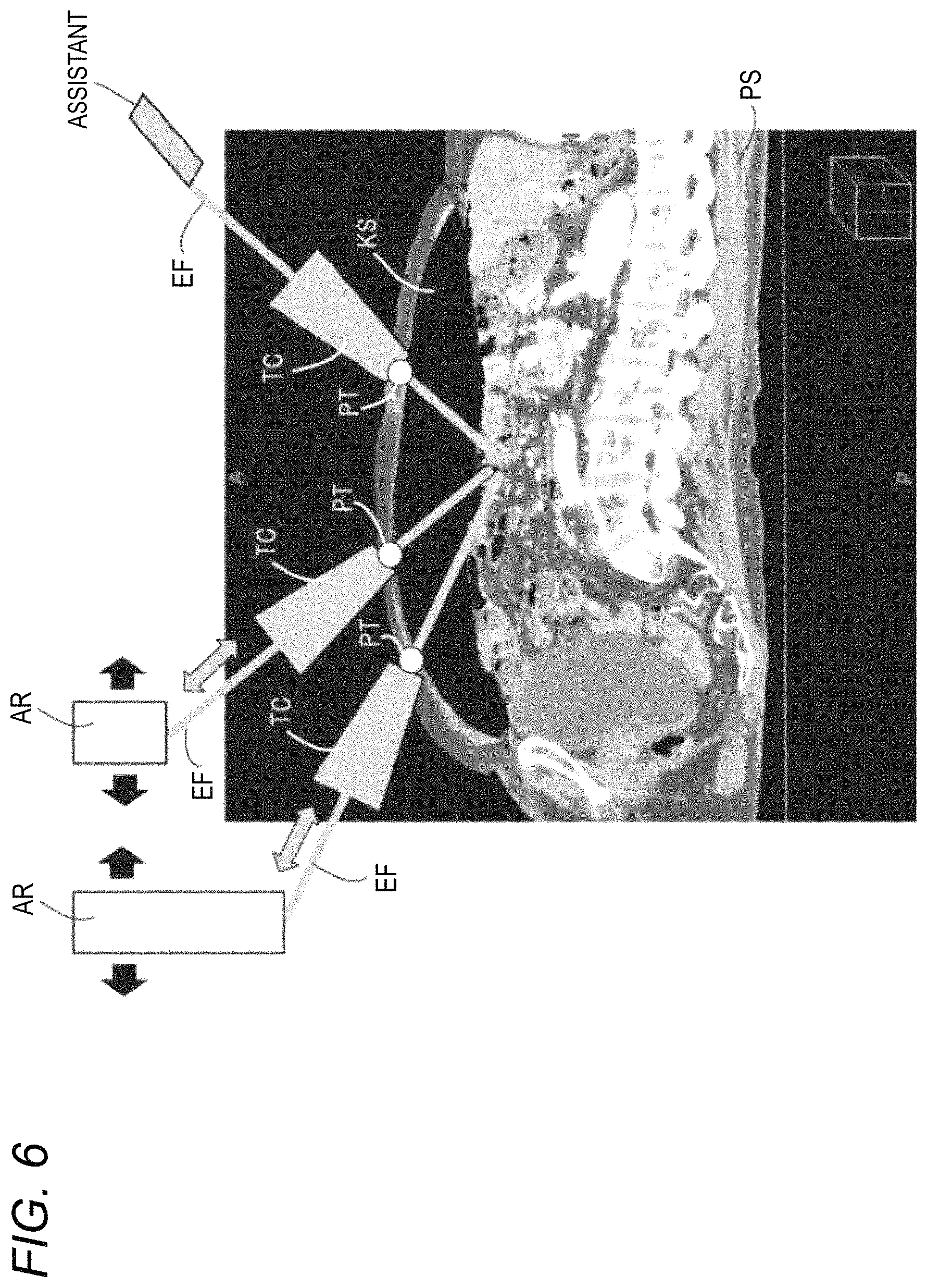 Patent US11771508 Figure 7 – Robotically-assisted surgical device, robotically-assisted surgery method, and system