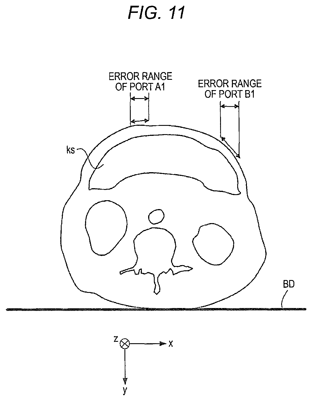 Patent US11771508 Figure 12 – Robotically-assisted surgical device, robotically-assisted surgery method, and system