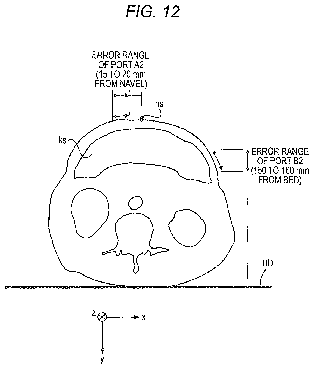 Patent US11771508 Figure 13 – Robotically-assisted surgical device, robotically-assisted surgery method, and system