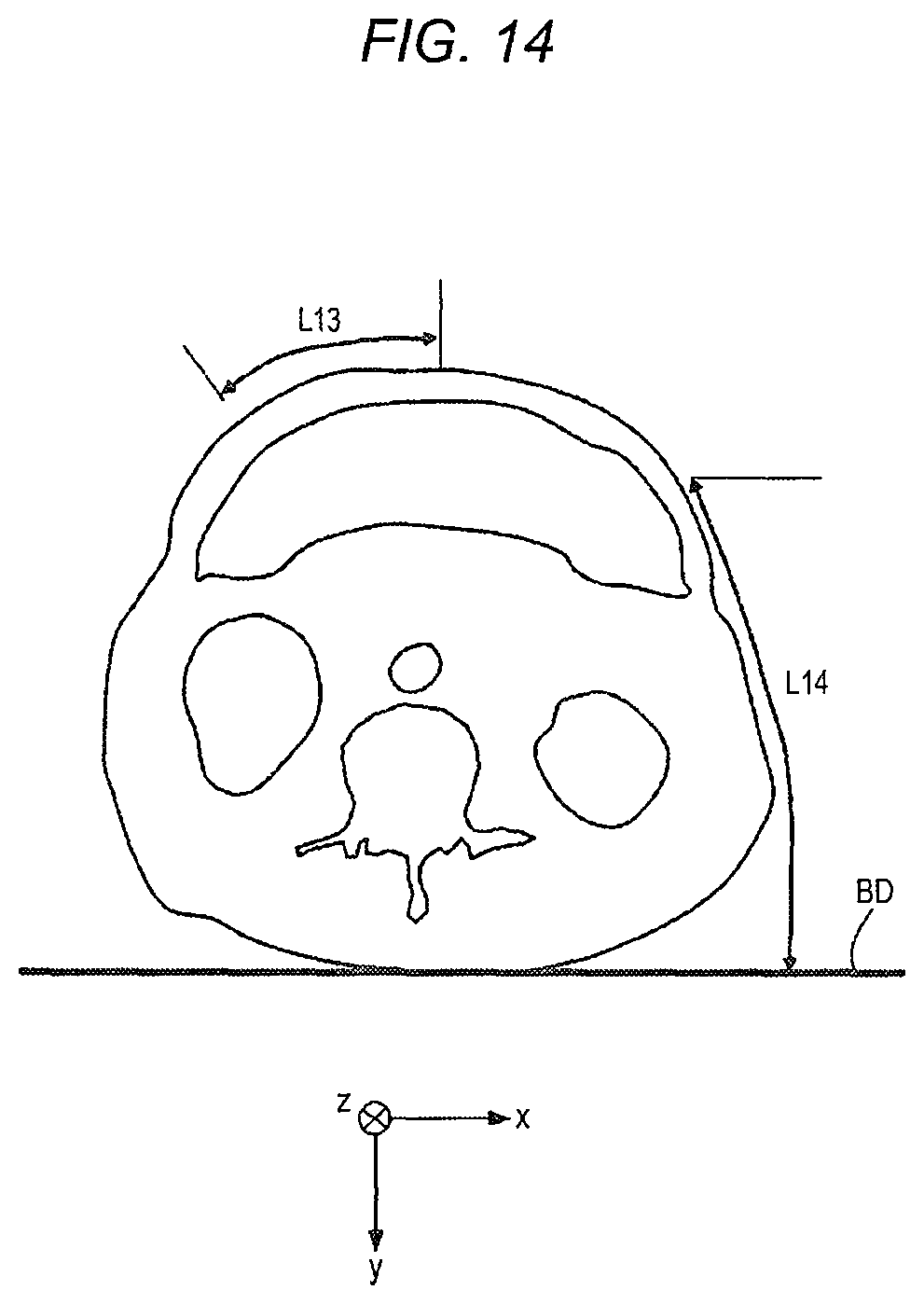 Patent US11771508 Figure 15 – Robotically-assisted surgical device, robotically-assisted surgery method, and system