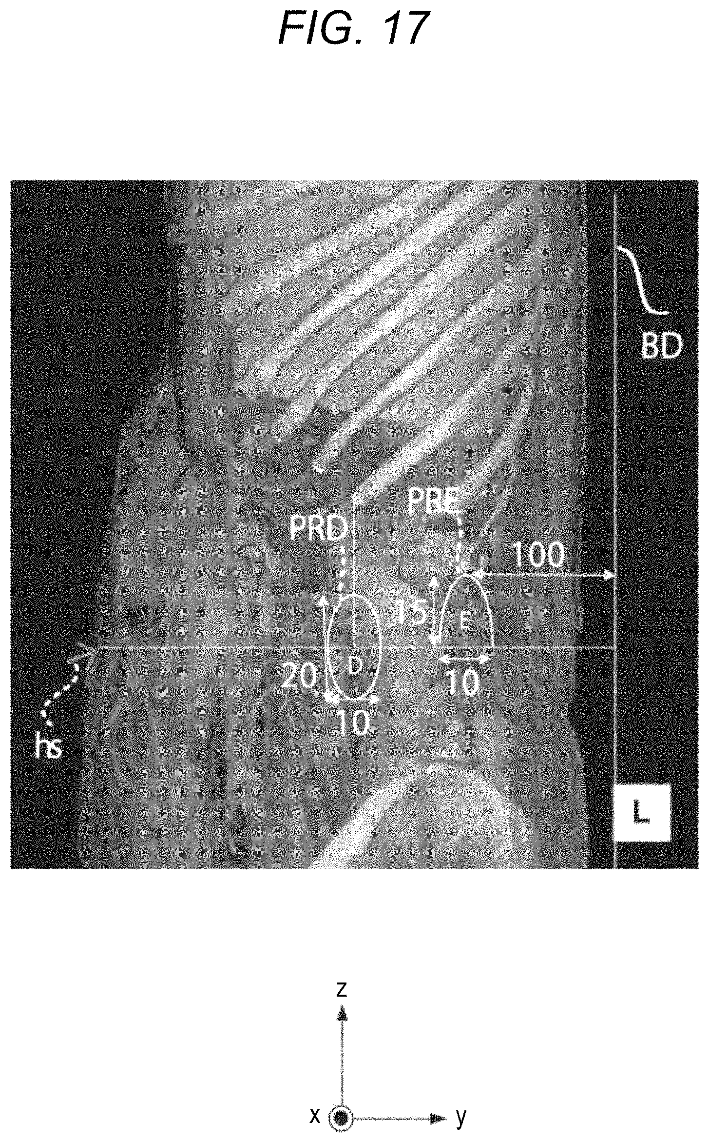 Patent US11771508 Figure 18 – Robotically-assisted surgical device, robotically-assisted surgery method, and system