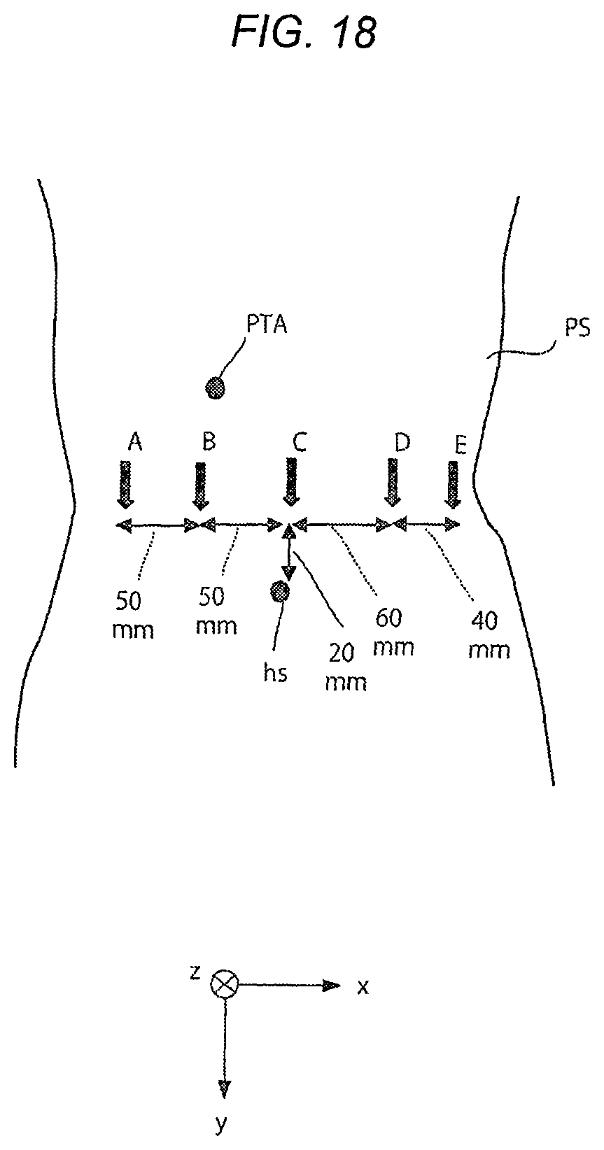 Patent US11771508 Figure 19 – Robotically-assisted surgical device, robotically-assisted surgery method, and system