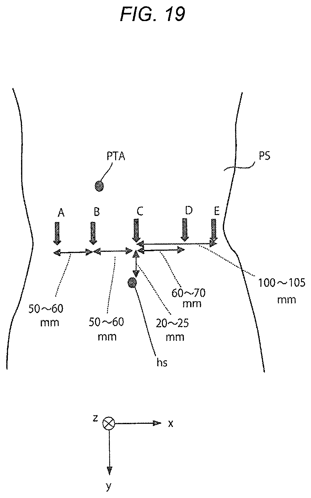 Patent US11771508 Figure 20 – Robotically-assisted surgical device, robotically-assisted surgery method, and system