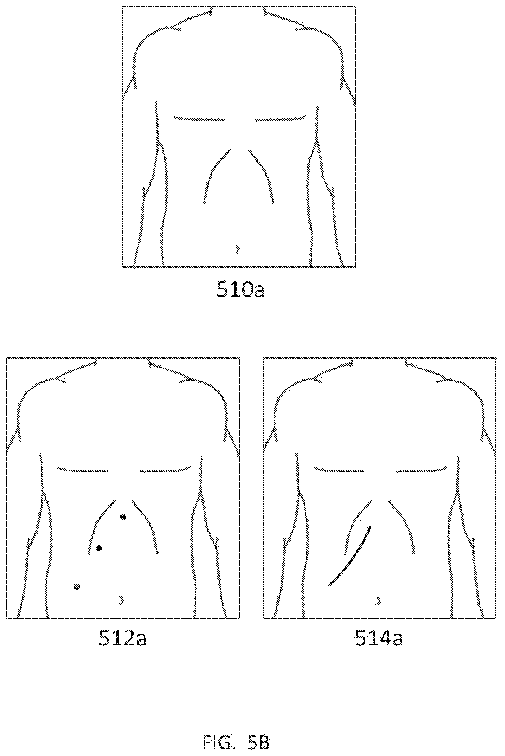 Patent US11771511 Figure 10 – Modular device comprising mechanical arms