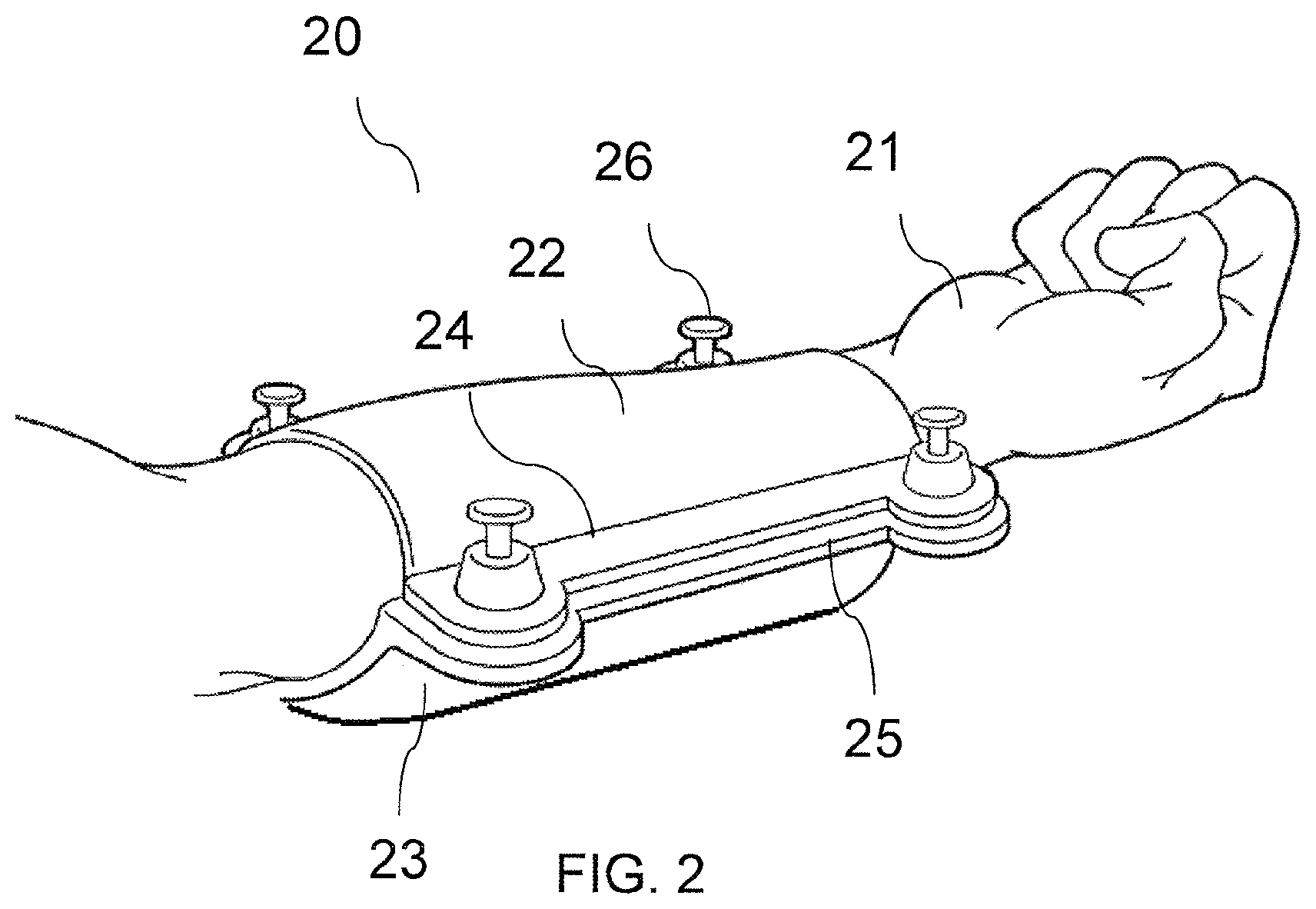 Patent US11771516 Figure 3 – Adjustable immobilizer apparatus and method for immobilizing a patient