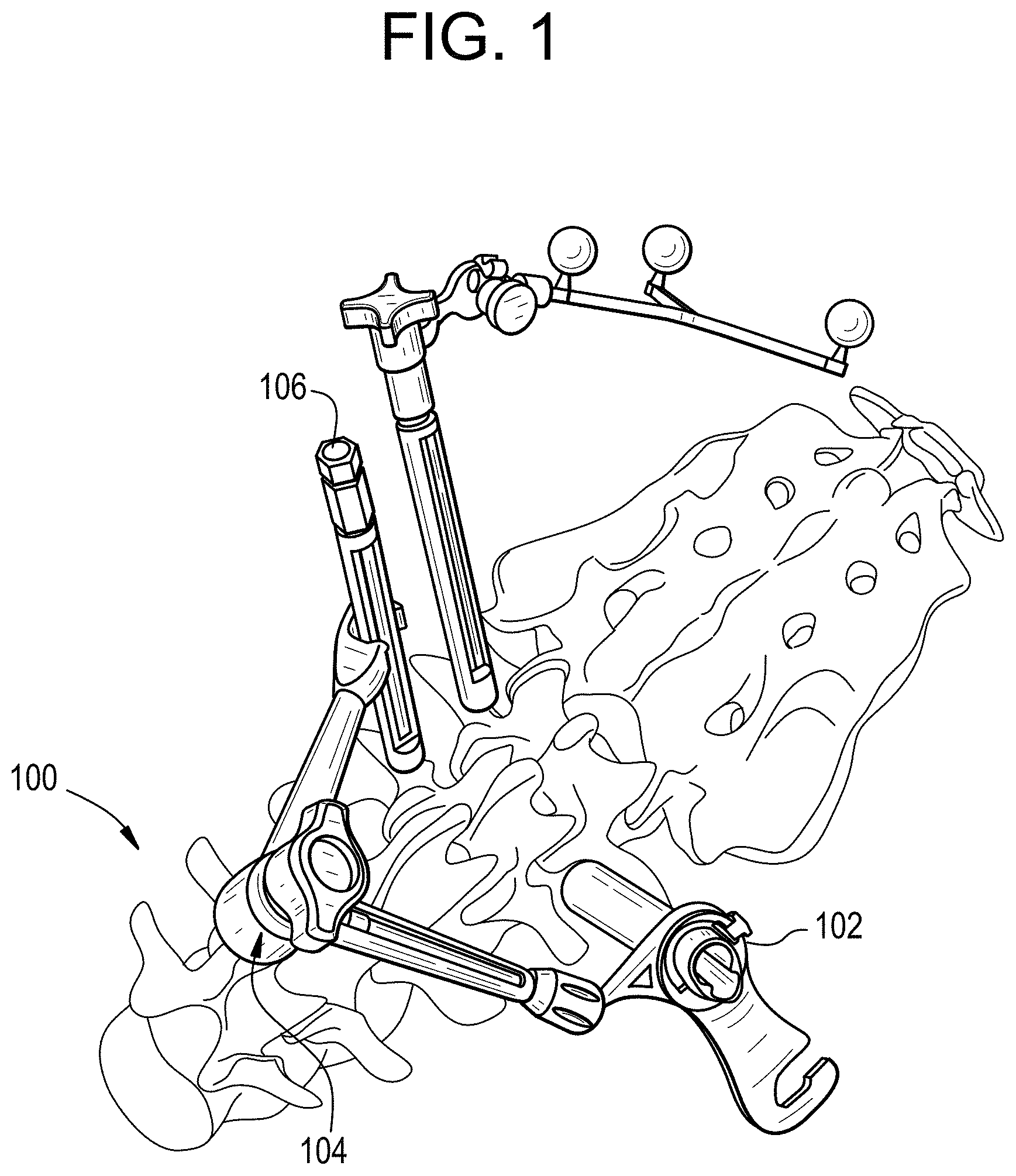 Patent US11771517 Figure 1 – Camera position indication systems and methods