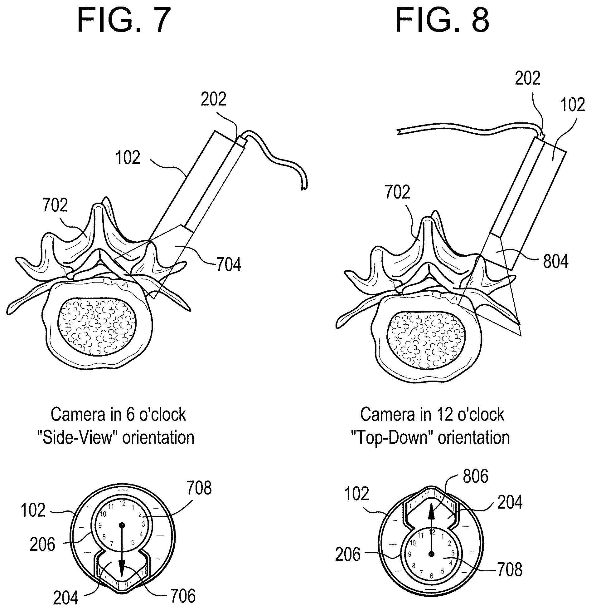 Patent US11771517 Figure 6 – Camera position indication systems and methods