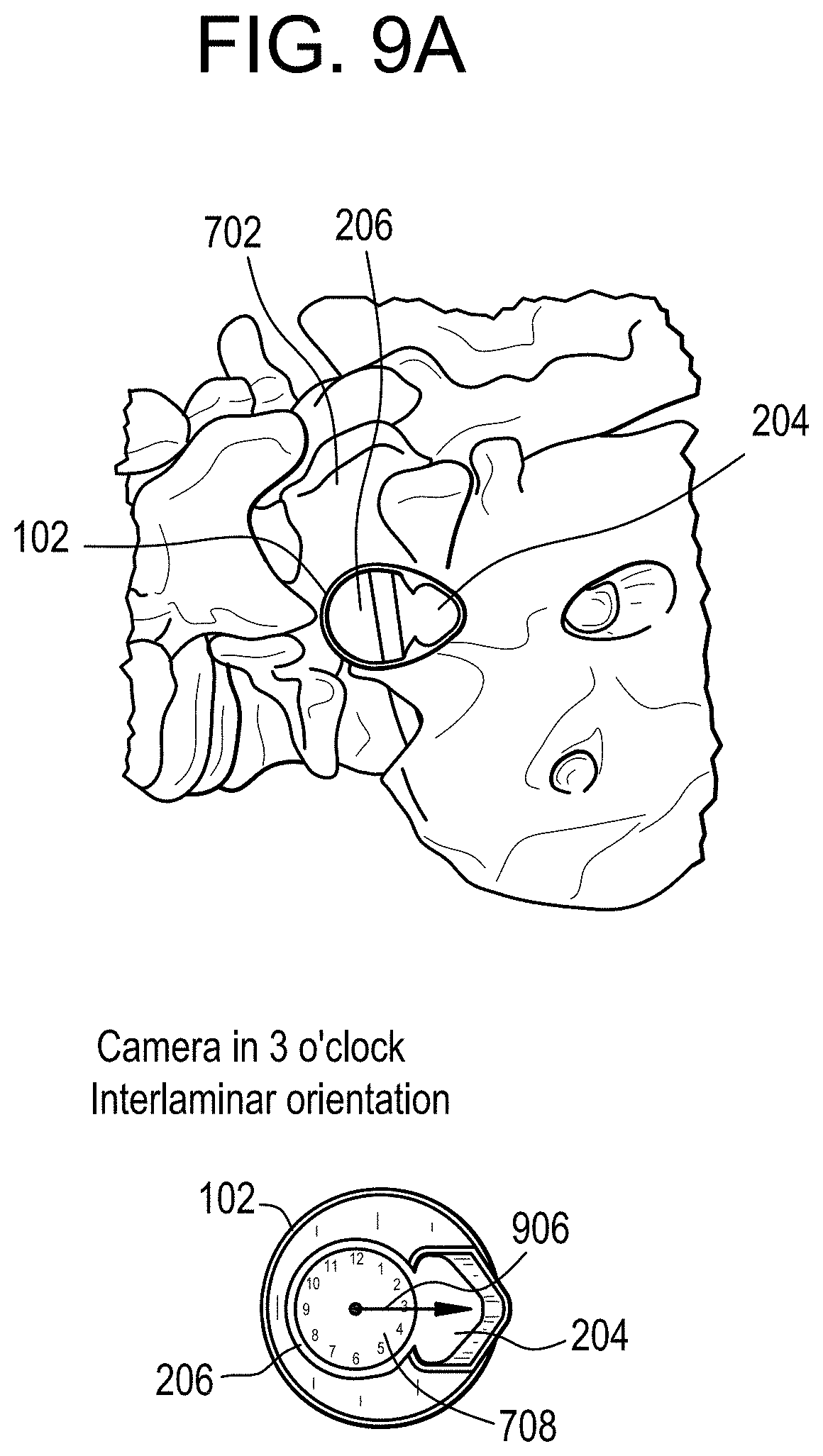 Patent US11771517 Figure 7 – Camera position indication systems and methods