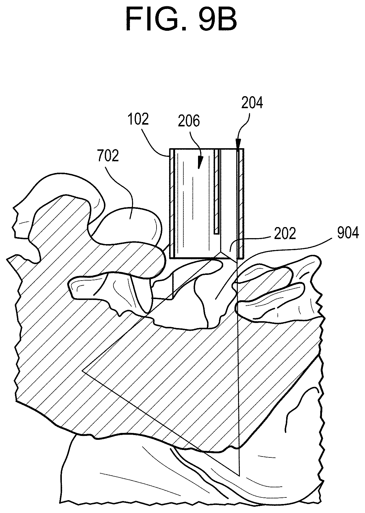 Patent US11771517 Figure 8 – Camera position indication systems and methods