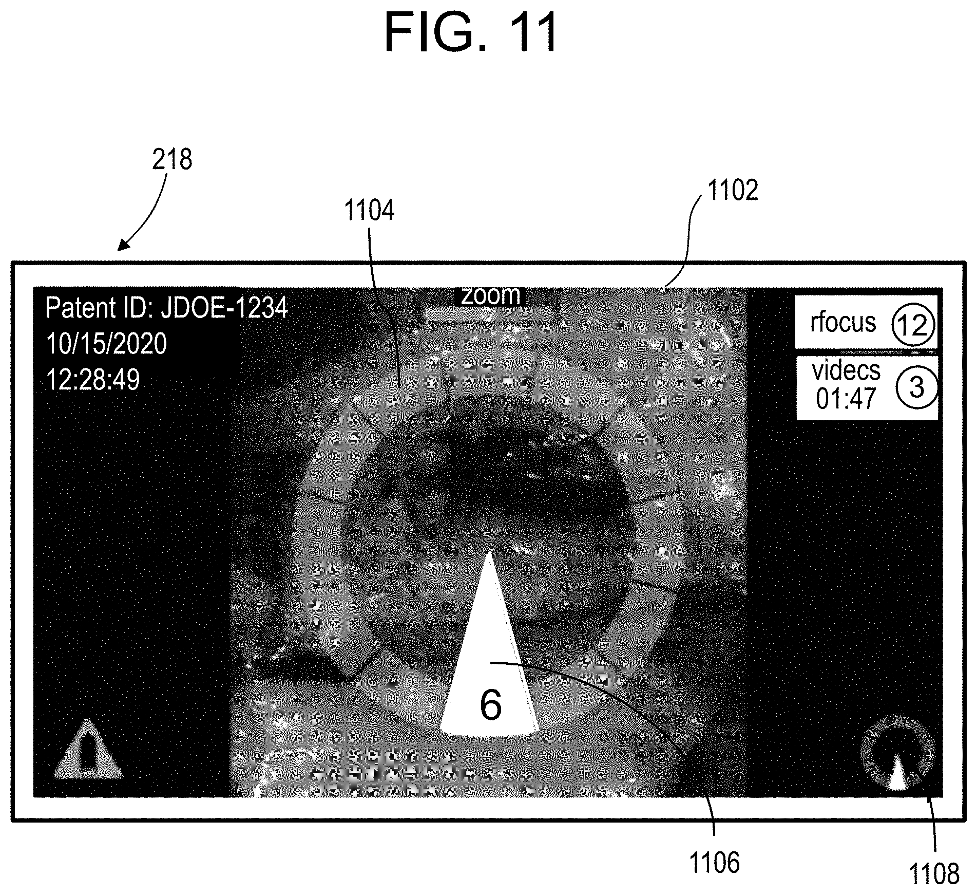 Patent US11771517 Figure 10 – Camera position indication systems and methods