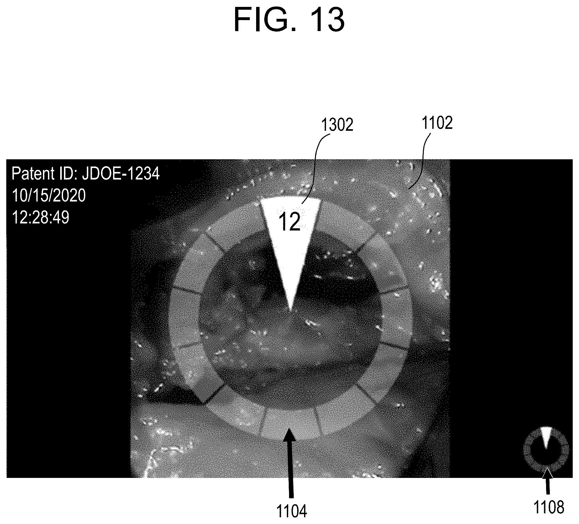 Patent US11771517 Figure 12 – Camera position indication systems and methods