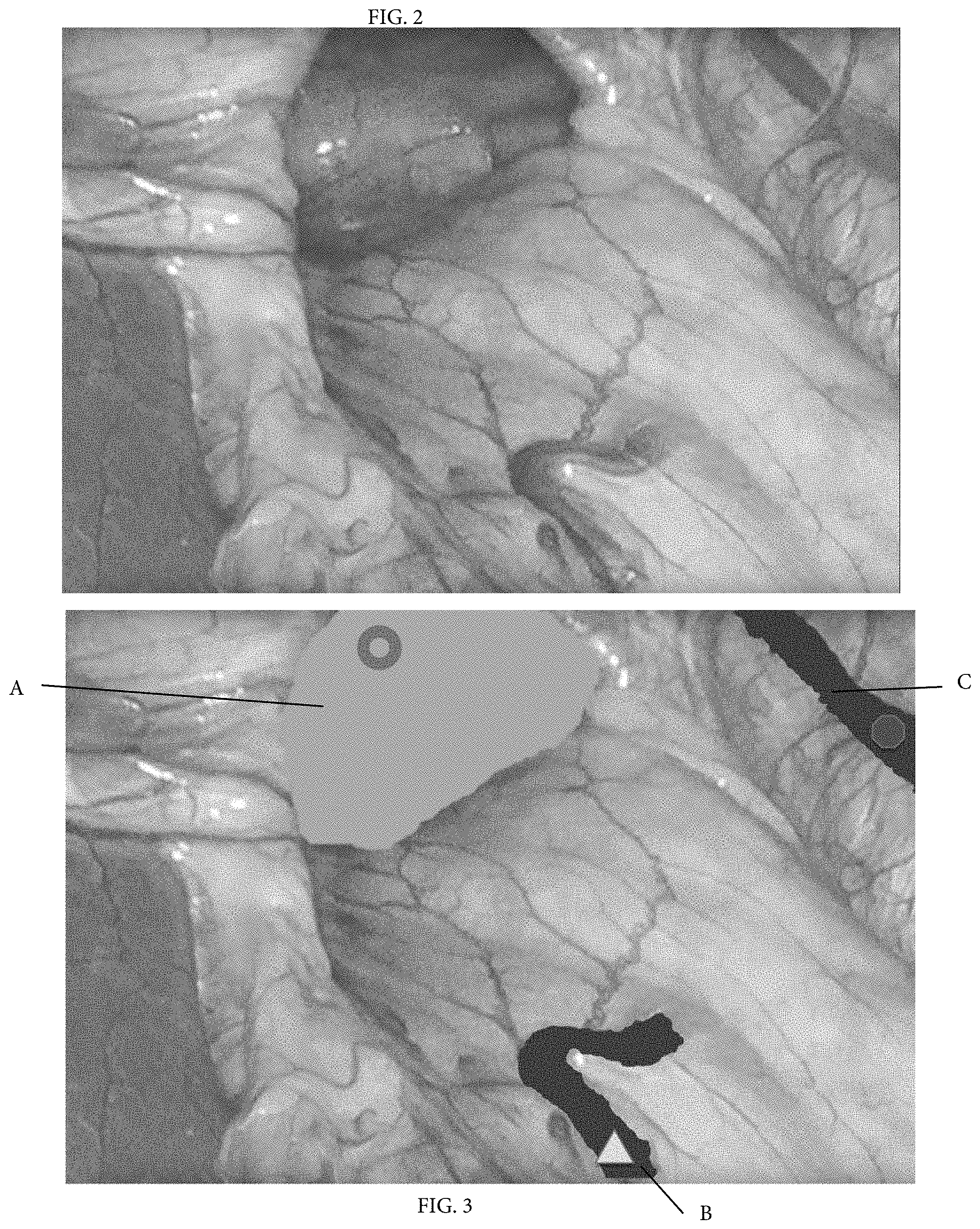 Patent US11771518 Figure 2 – Method of graphically tagging and recalling identified structures under visualization for robotic surgery