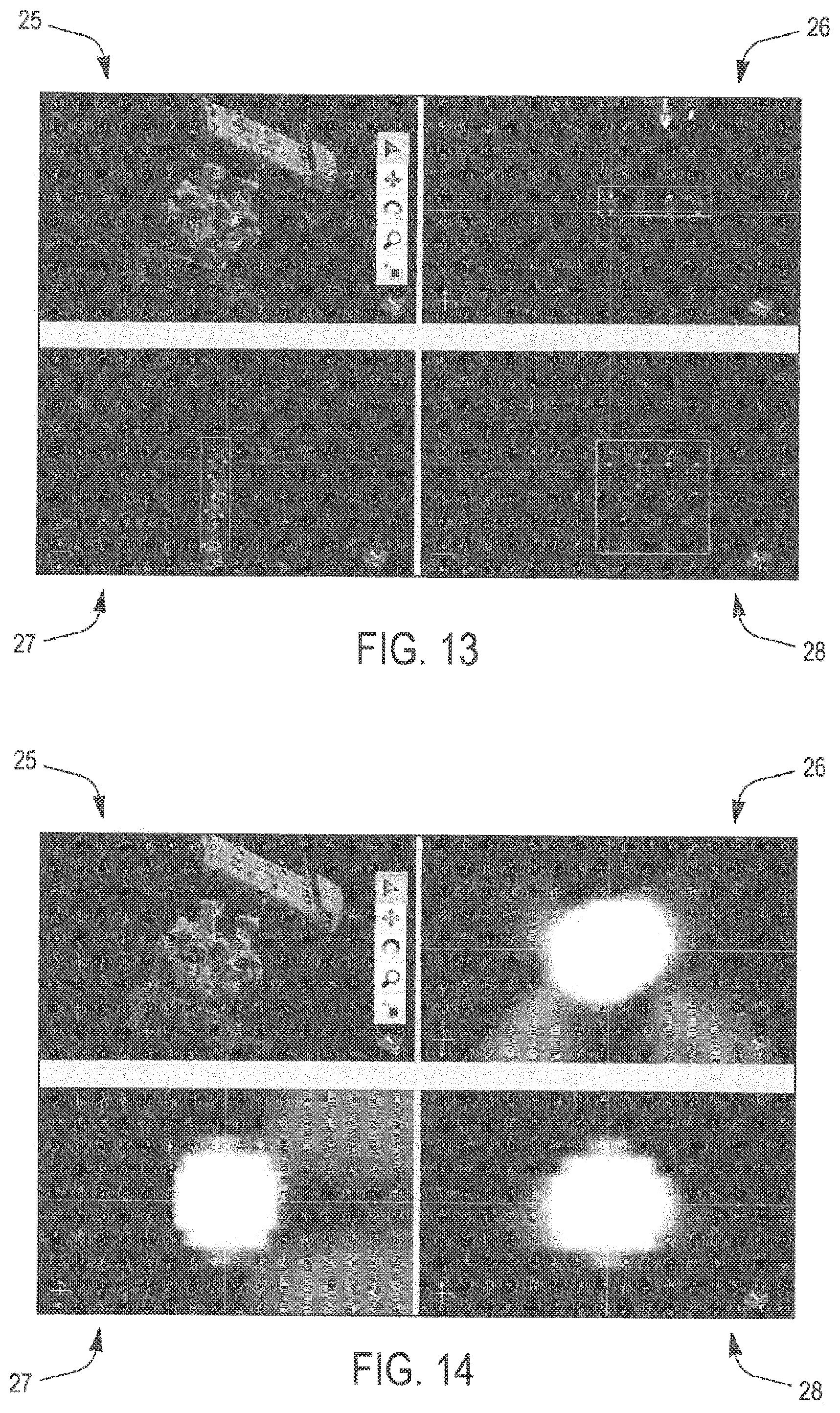 Patent US11771519 Figure 5 – Device and method for automatic recalibration for 3D intraoperative images