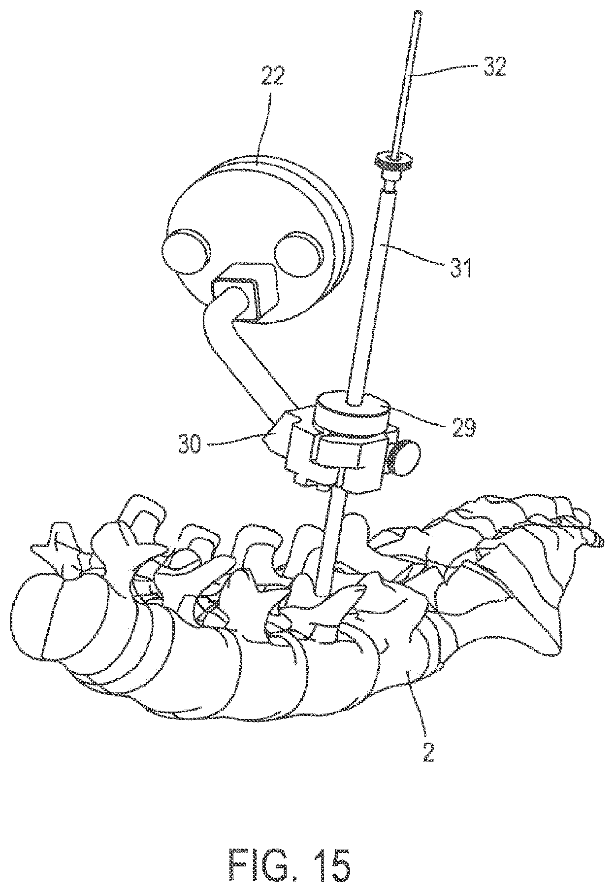 Patent US11771519 Figure 6 – Device and method for automatic recalibration for 3D intraoperative images
