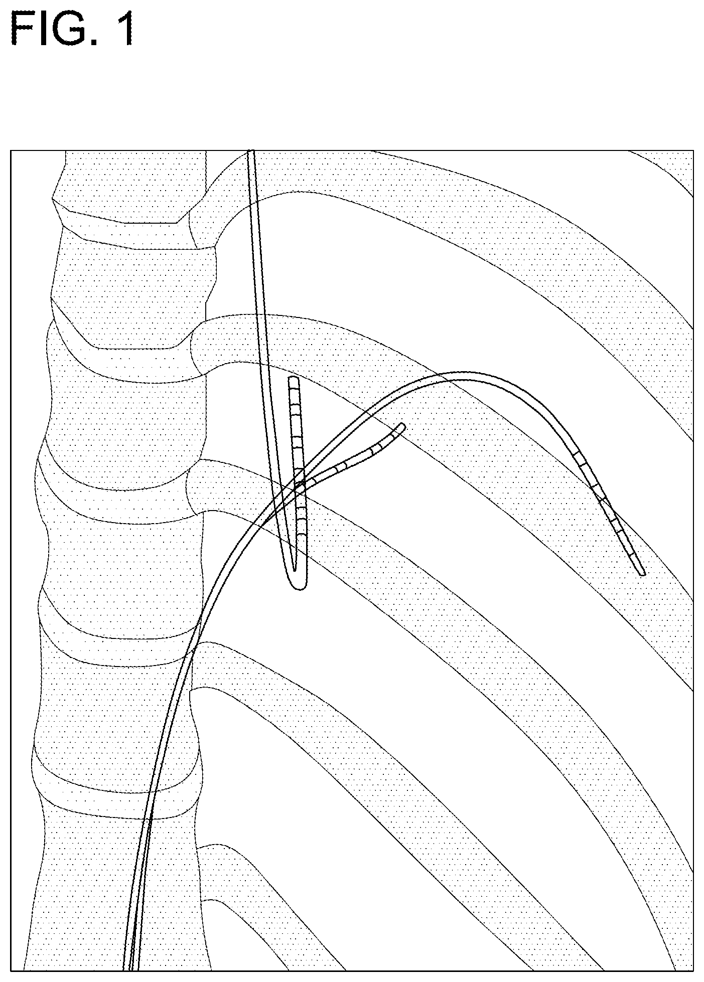 Patent US11771520 Figure 1 – System and method for virtual reality data integration and visualization for 3D imaging and instrument position data