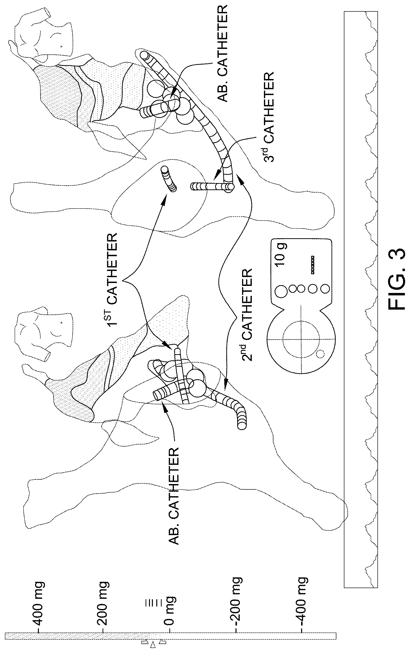 Patent US11771520 Figure 3 – System and method for virtual reality data integration and visualization for 3D imaging and instrument position data