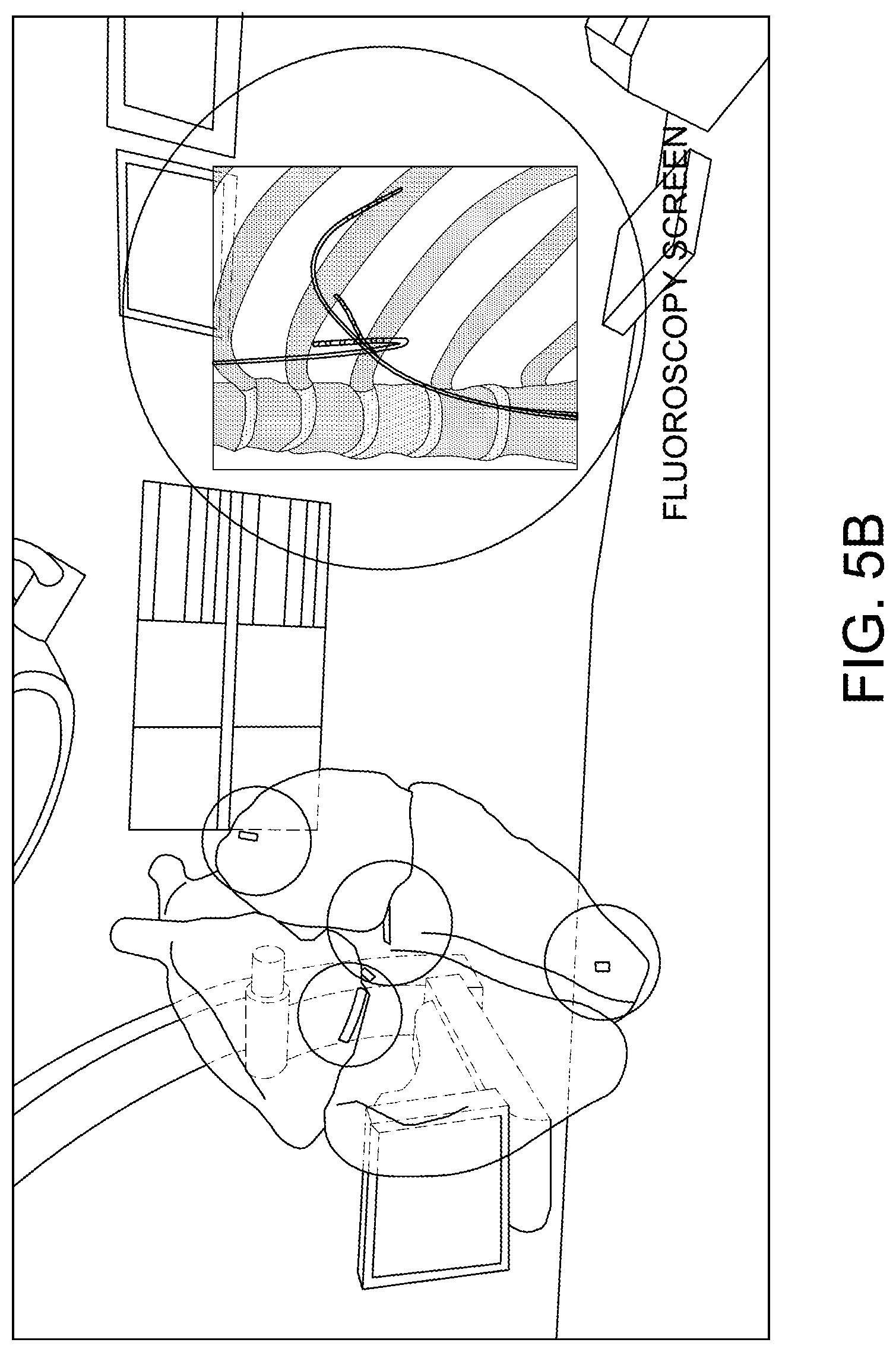 Patent US11771520 Figure 6 – System and method for virtual reality data integration and visualization for 3D imaging and instrument position data