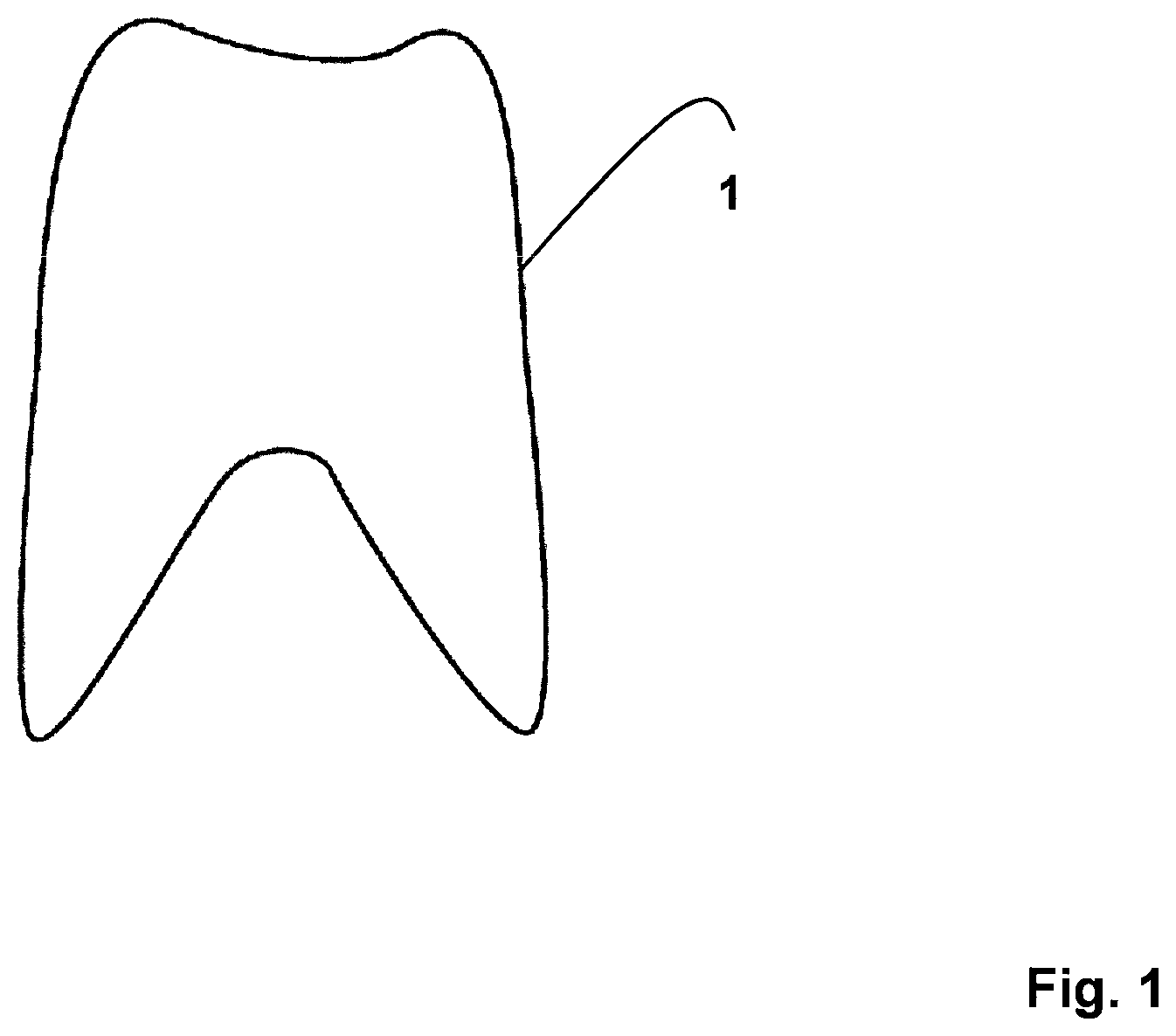 Patent US11771523 — Method for the design and manufacture of a dental component — Figure 1