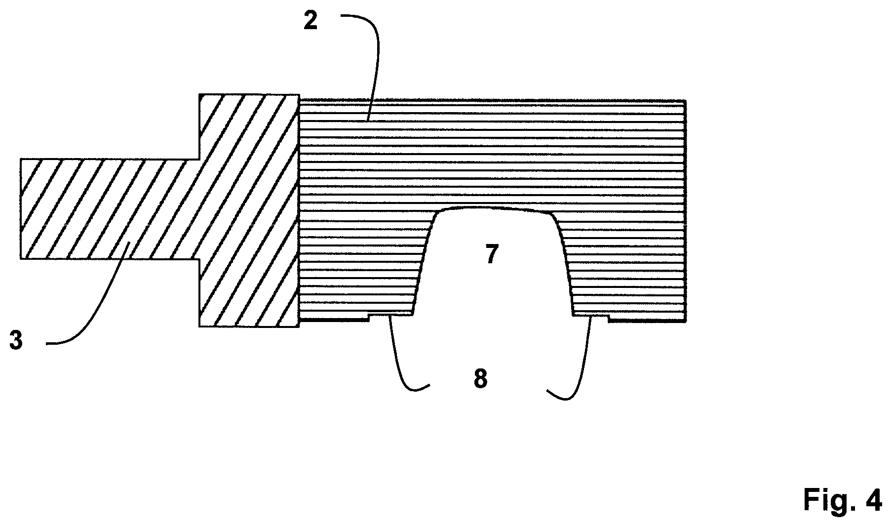 Patent US11771523 Figure 4 – Method for the design and manufacture of a dental component