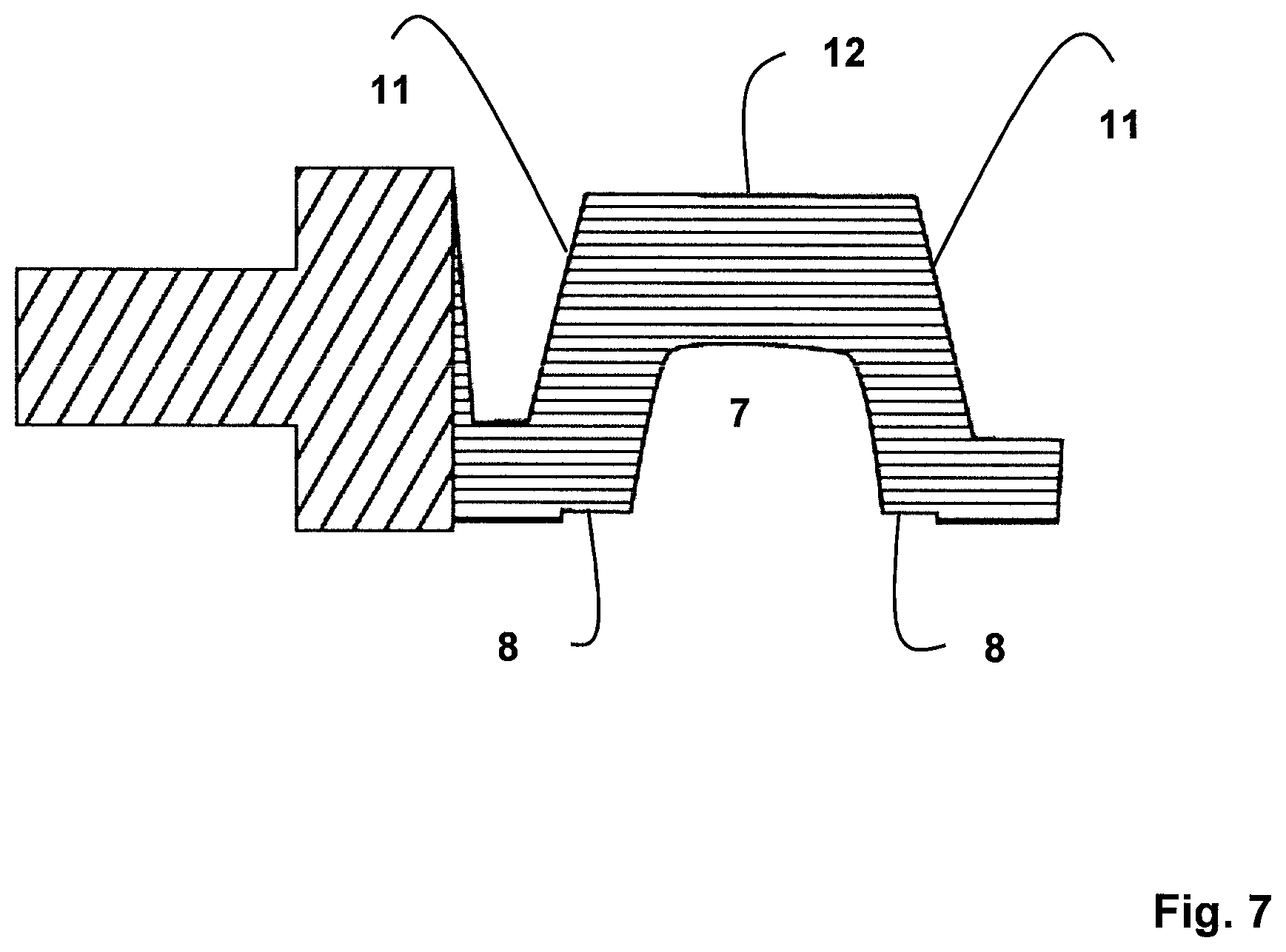 Patent US11771523 Figure 7 – Method for the design and manufacture of a dental component