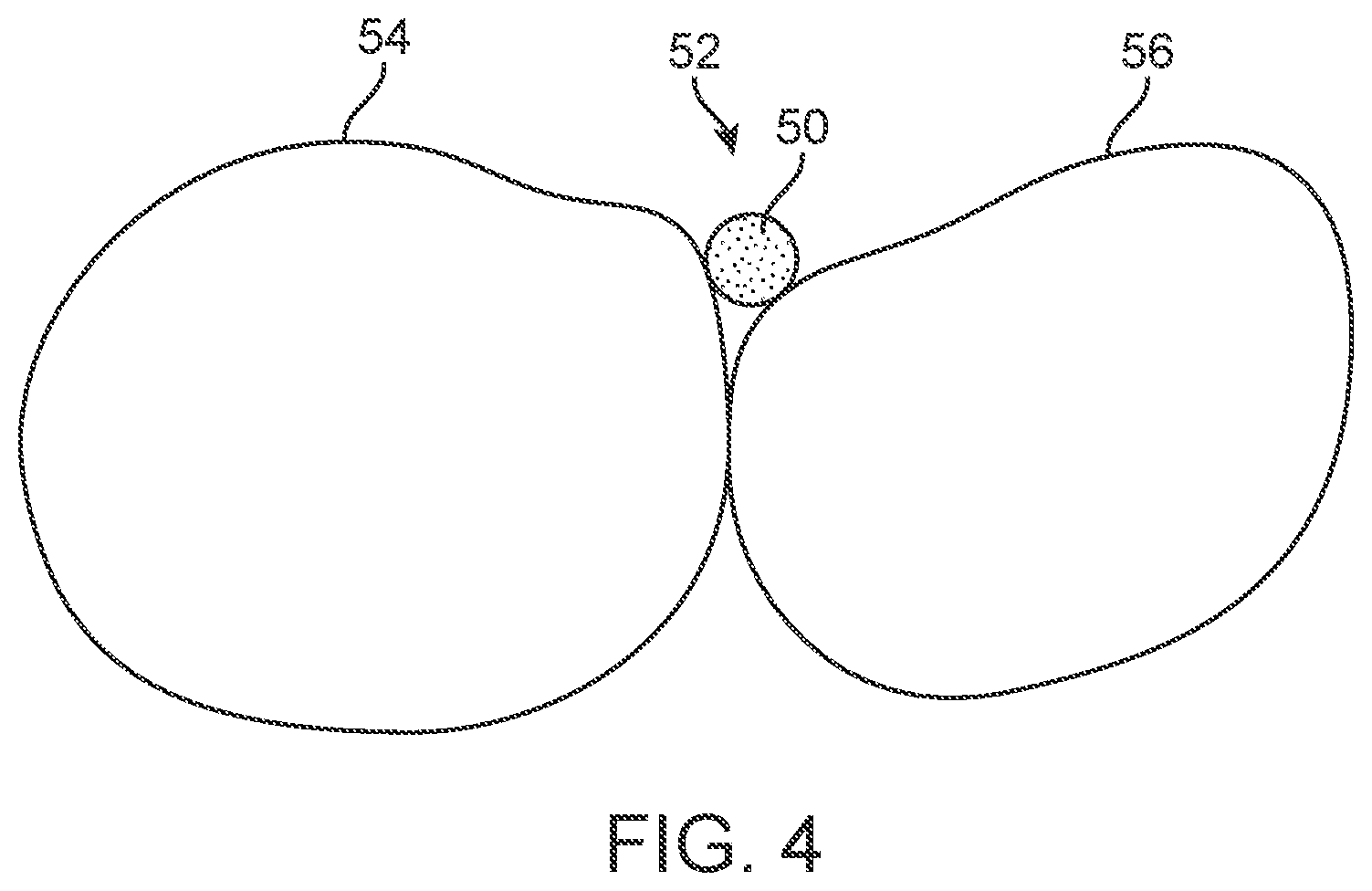 Patent US11771524 Figure 2 – Three-dimensional printed dental appliances using support structures