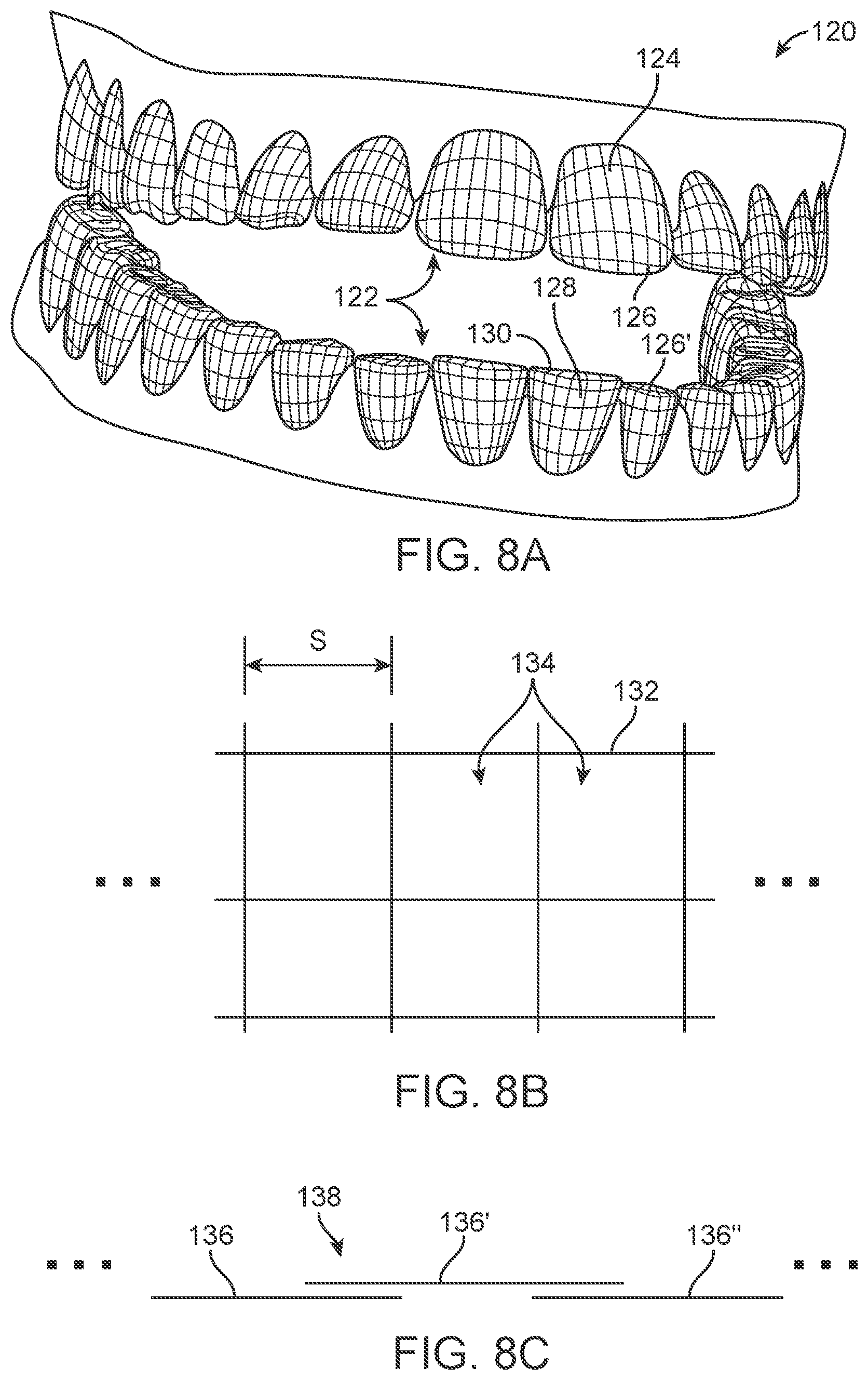Patent US11771524 Figure 6 – Three-dimensional printed dental appliances using support structures