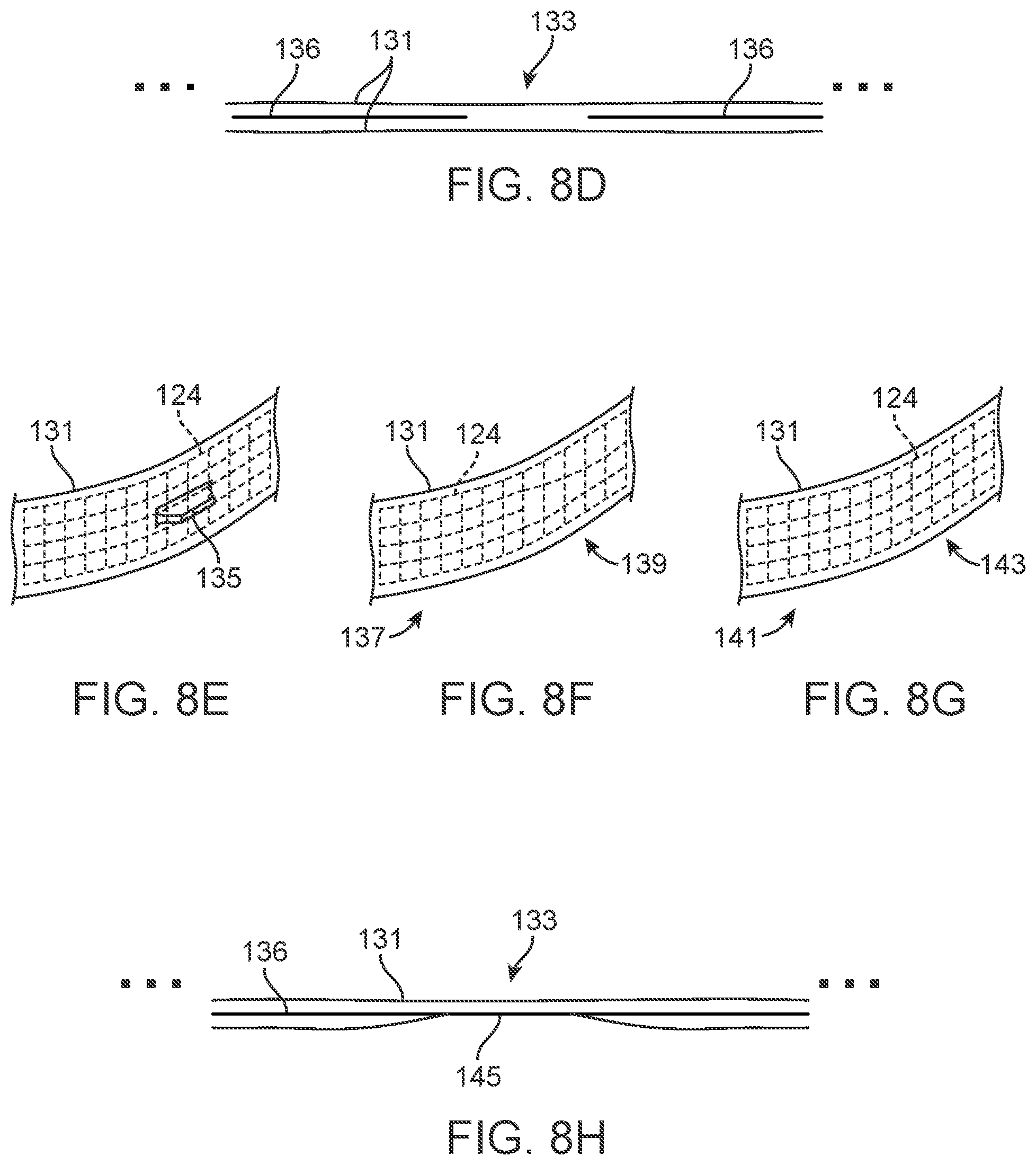 Patent US11771524 Figure 7 – Three-dimensional printed dental appliances using support structures