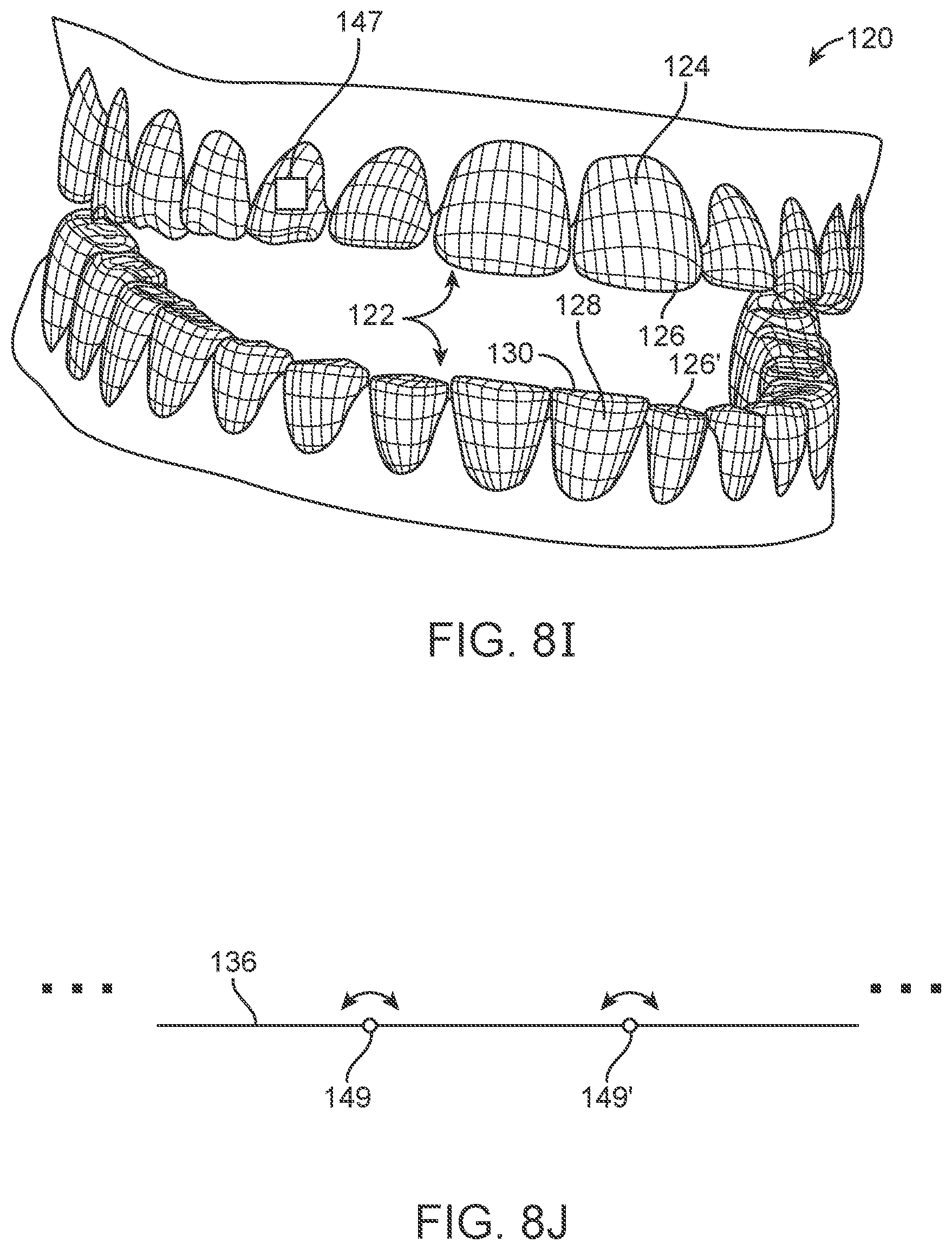 Patent US11771524 Figure 8 – Three-dimensional printed dental appliances using support structures
