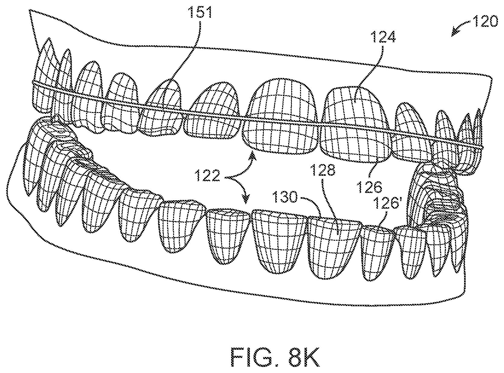 Patent US11771524 Figure 9 – Three-dimensional printed dental appliances using support structures